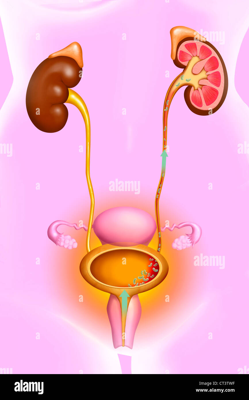 Renal Pelvis Stock Photos & Renal Pelvis Stock Images Alamy