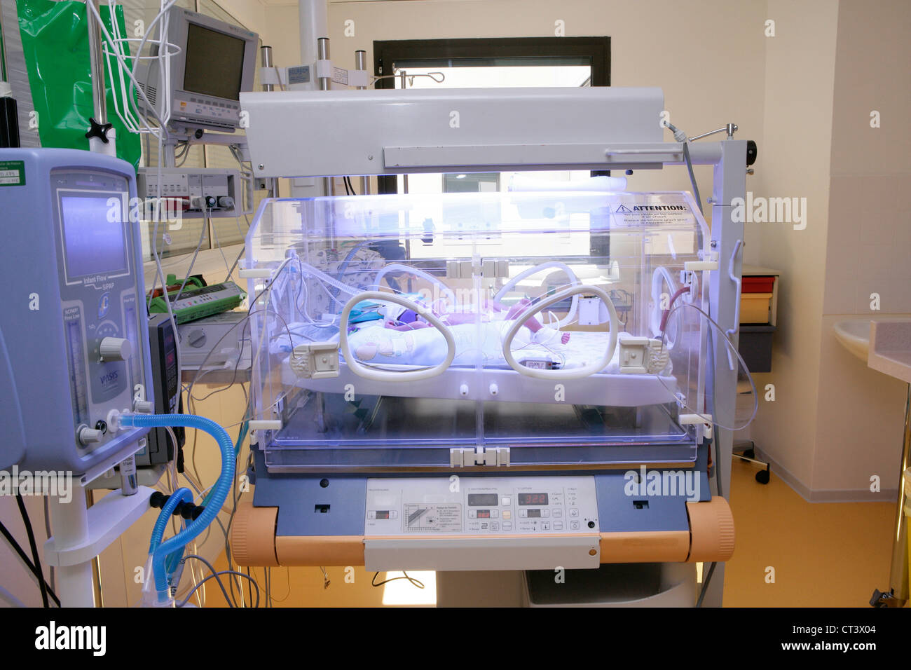 Neonatal Jaundice Phototherapy