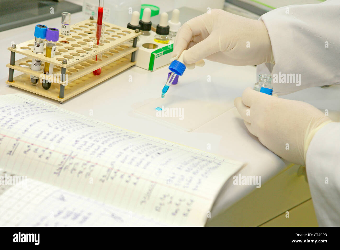 Abo blood type testing hi-res stock photography and images - Alamy