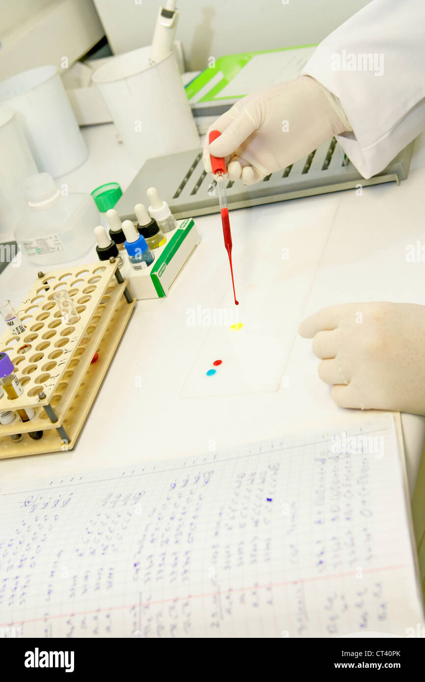 Abo blood type testing hi-res stock photography and images - Alamy