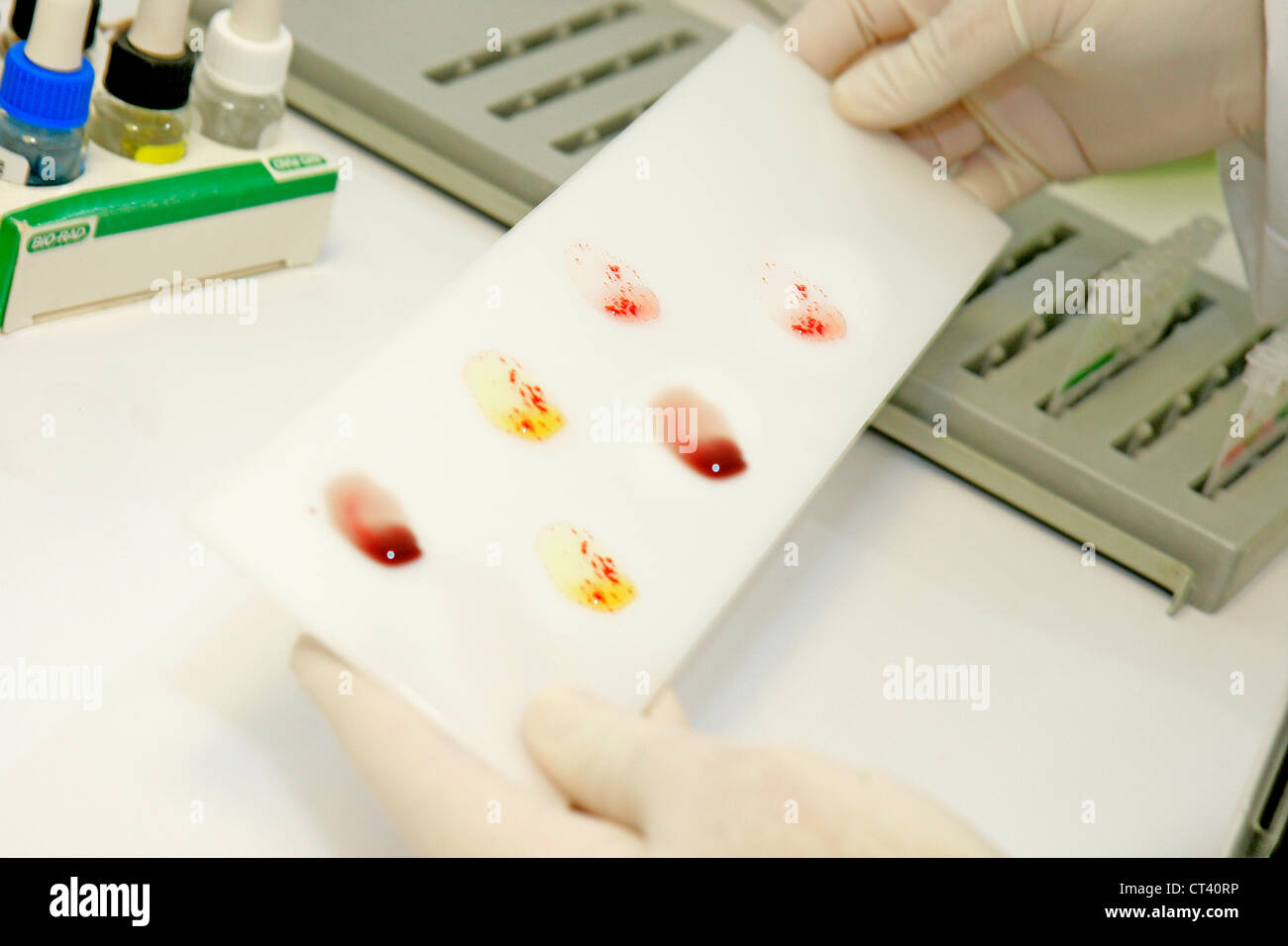 Abo blood type testing hi-res stock photography and images - Alamy