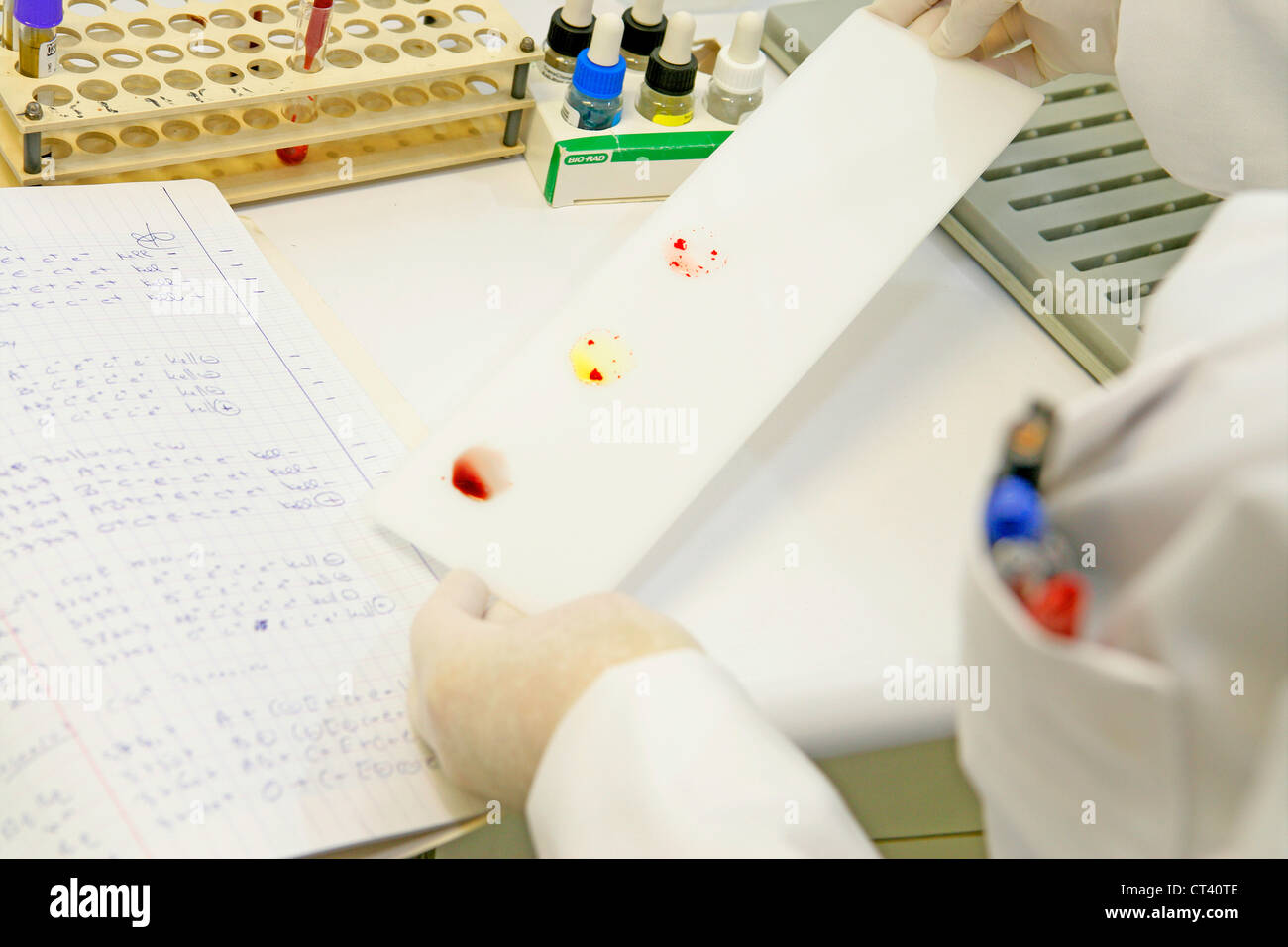 Abo blood type testing hi-res stock photography and images - Alamy