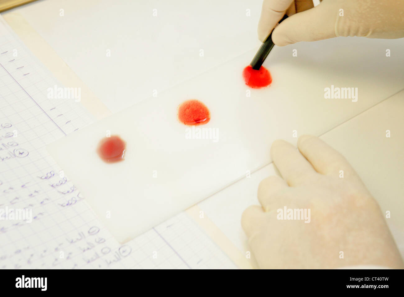 Abo blood type testing hi-res stock photography and images - Alamy