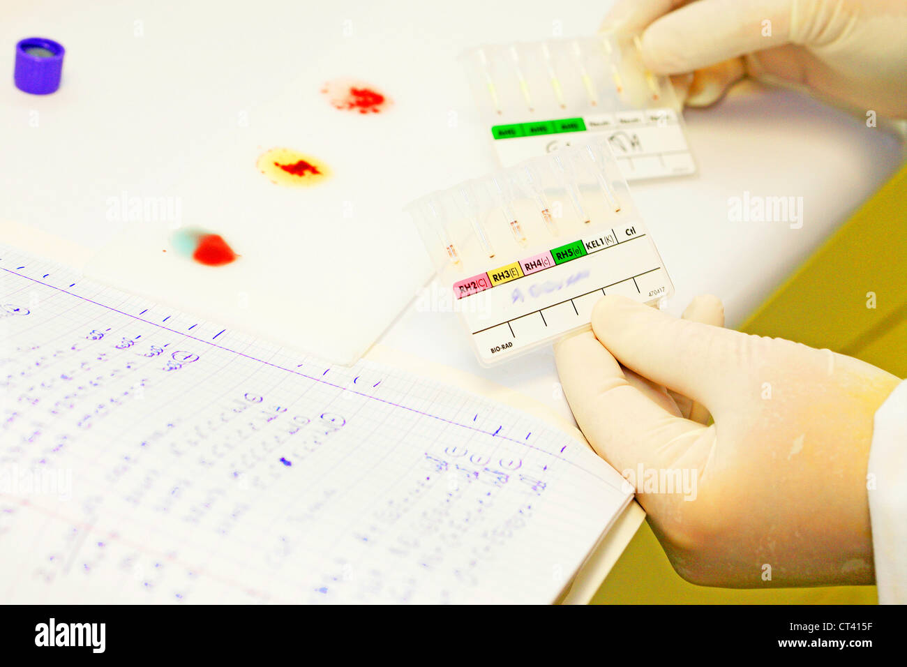 Abo blood type testing hi-res stock photography and images - Alamy