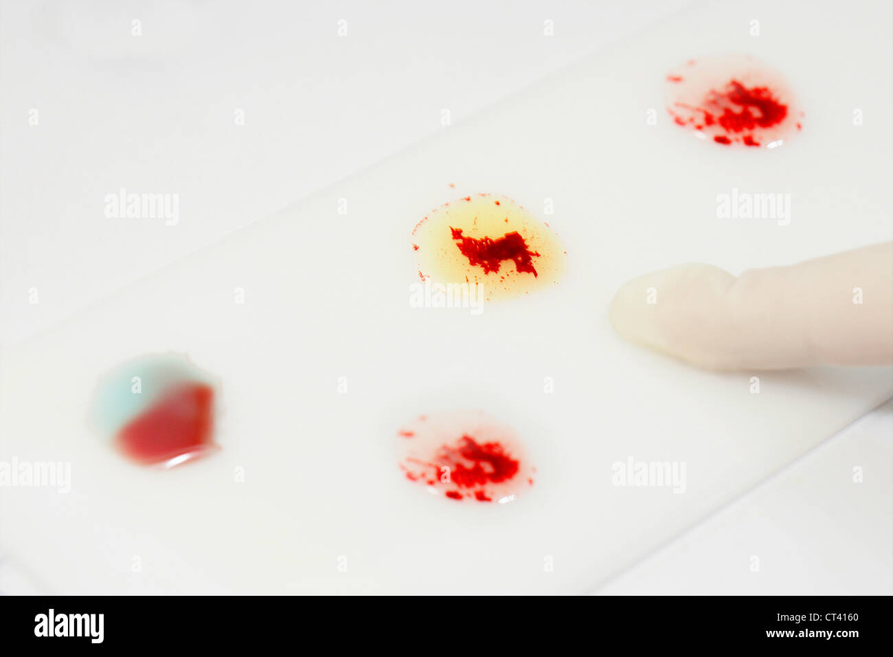 Abo blood type testing hi-res stock photography and images - Alamy