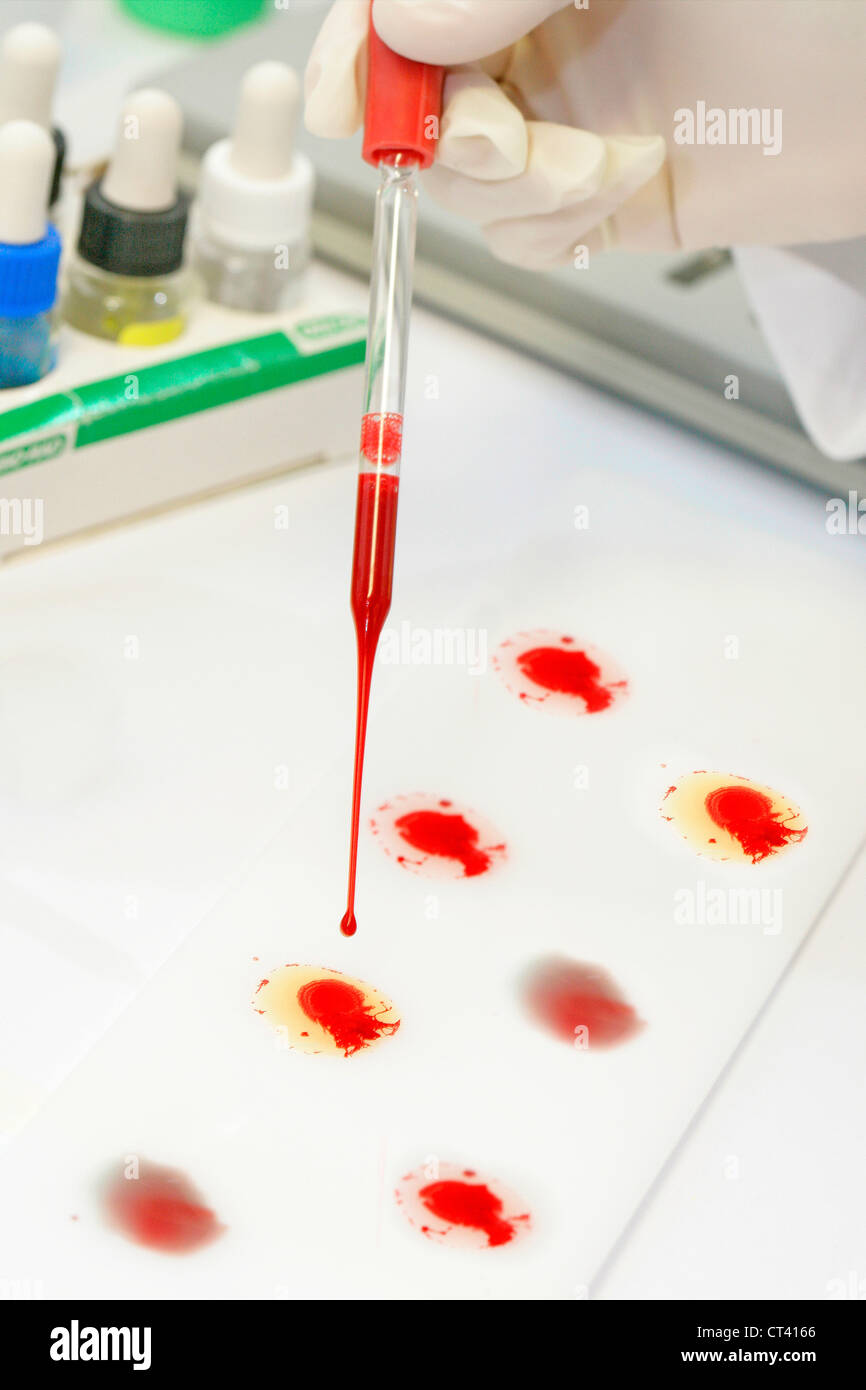 Abo blood type testing hi-res stock photography and images - Alamy