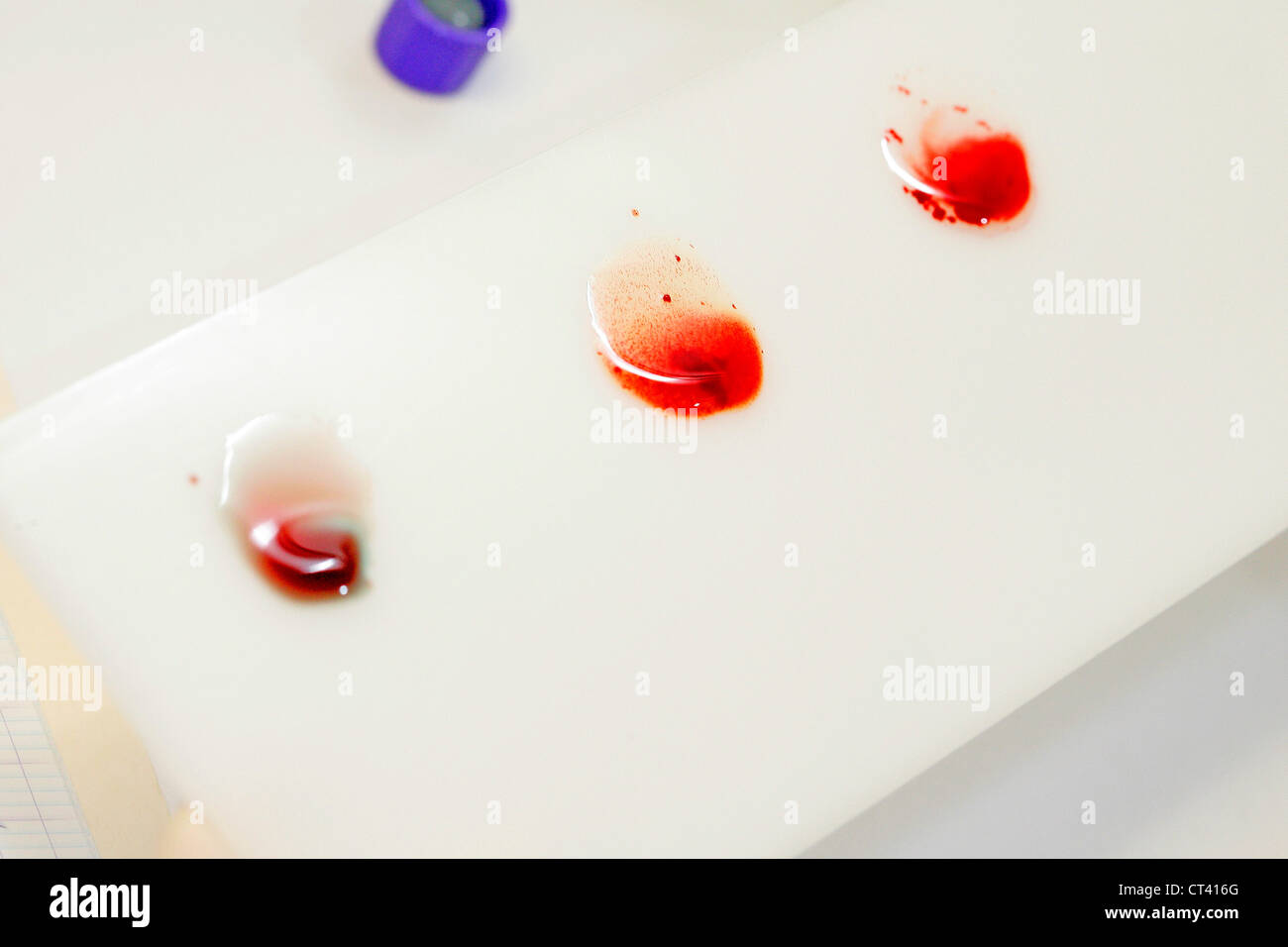 Abo blood type testing hi-res stock photography and images - Alamy