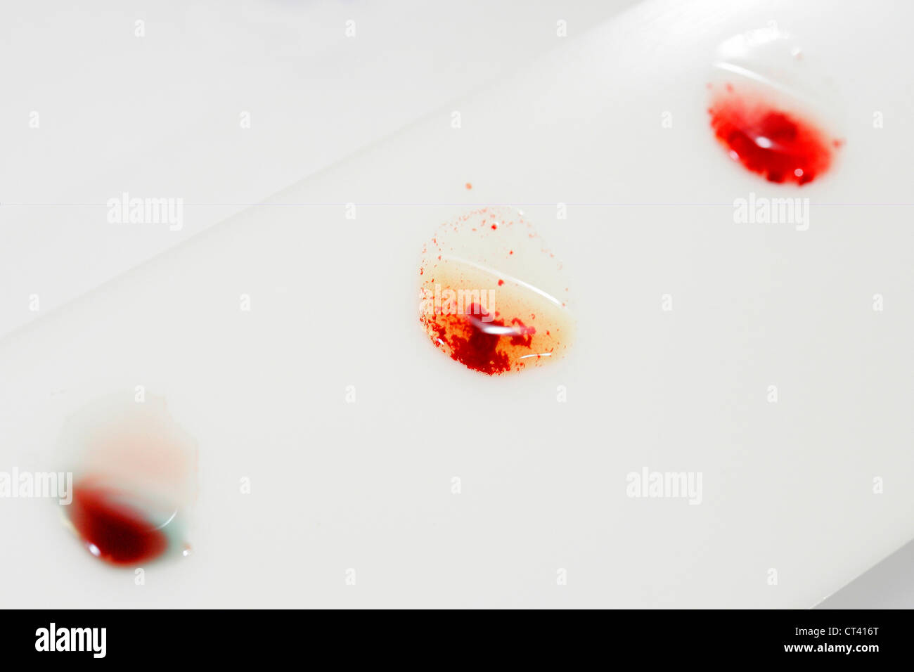 Abo blood type testing hi-res stock photography and images - Alamy