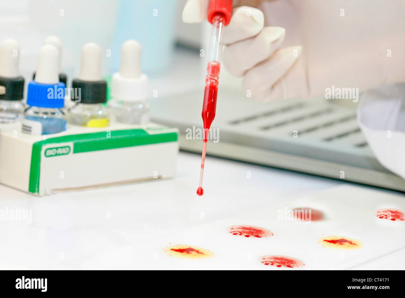 Abo blood type testing hi-res stock photography and images - Alamy
