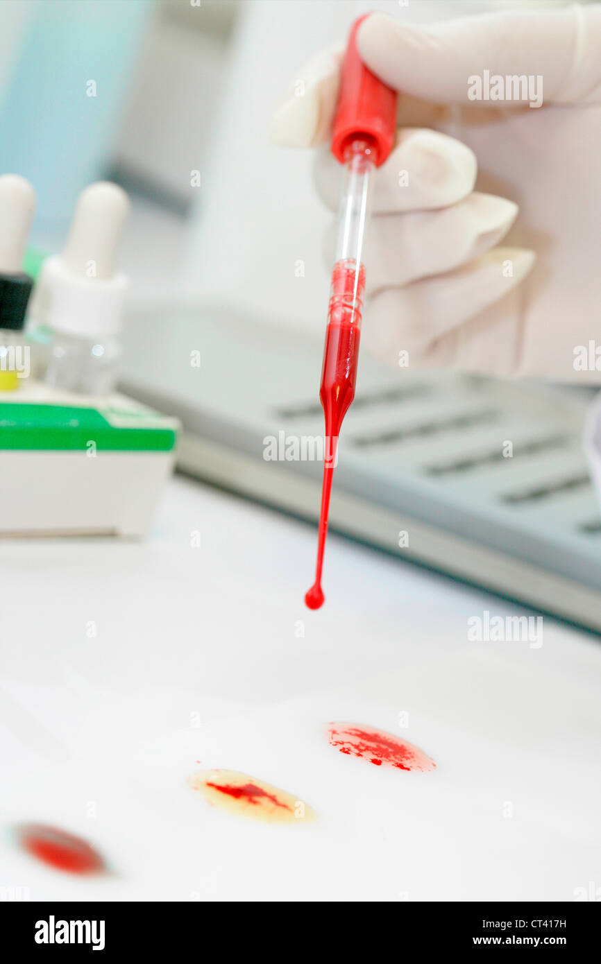 Abo blood type hi-res stock photography and images - Alamy
