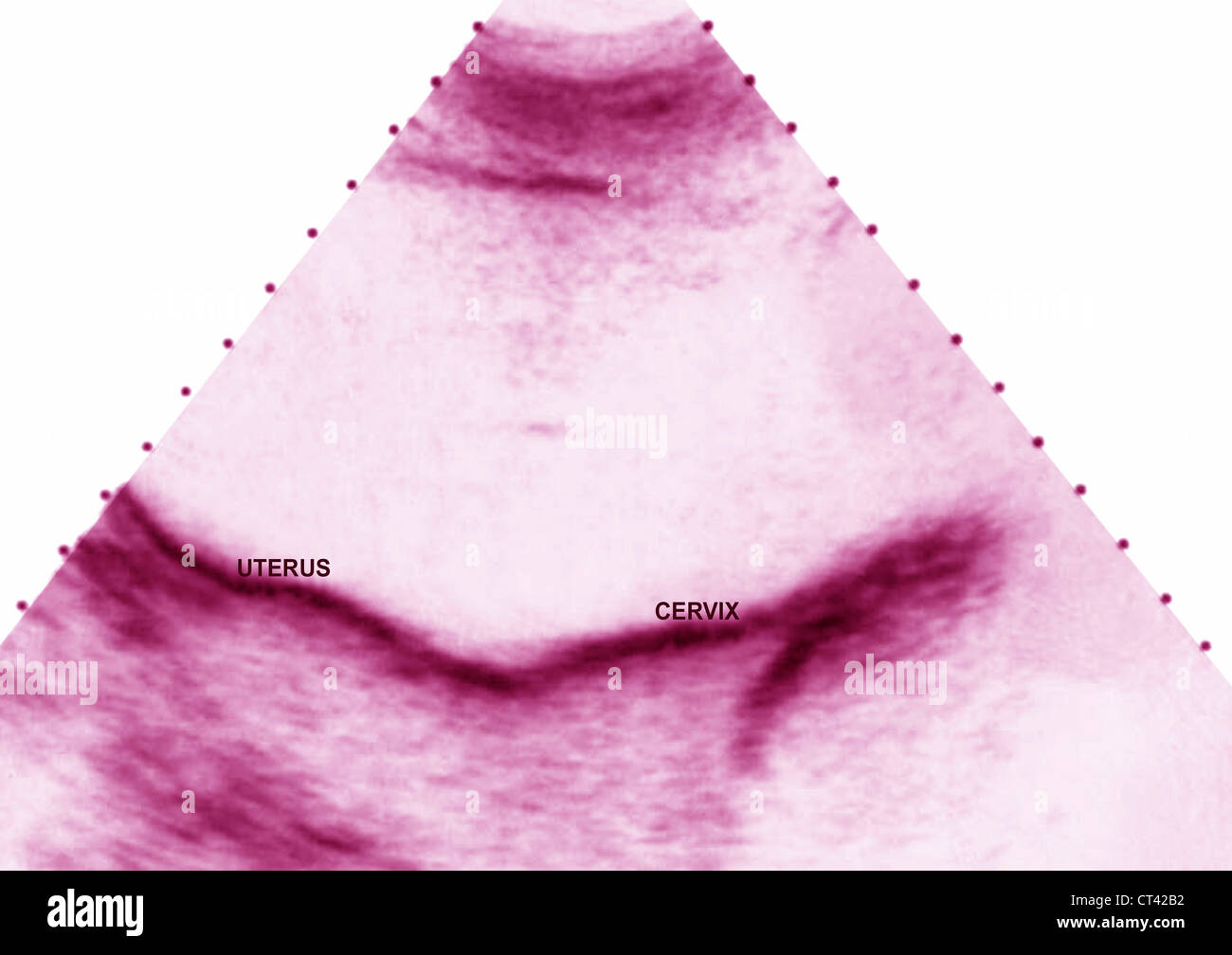 Uturus Graph Normal uterus hi-res stock photography and images - Alamy
