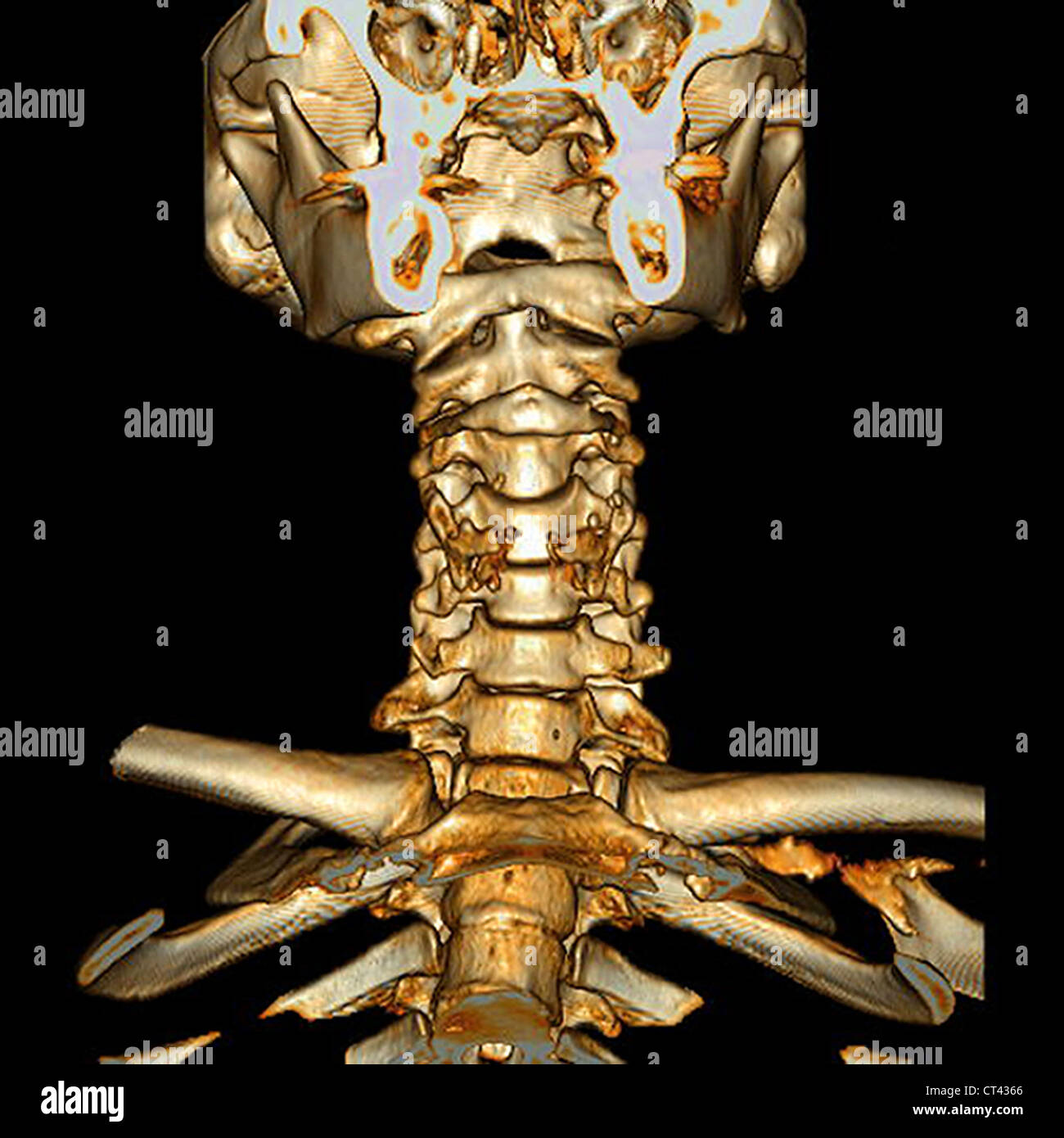 CERVICAL, 3D SCAN Stock Photo - Alamy