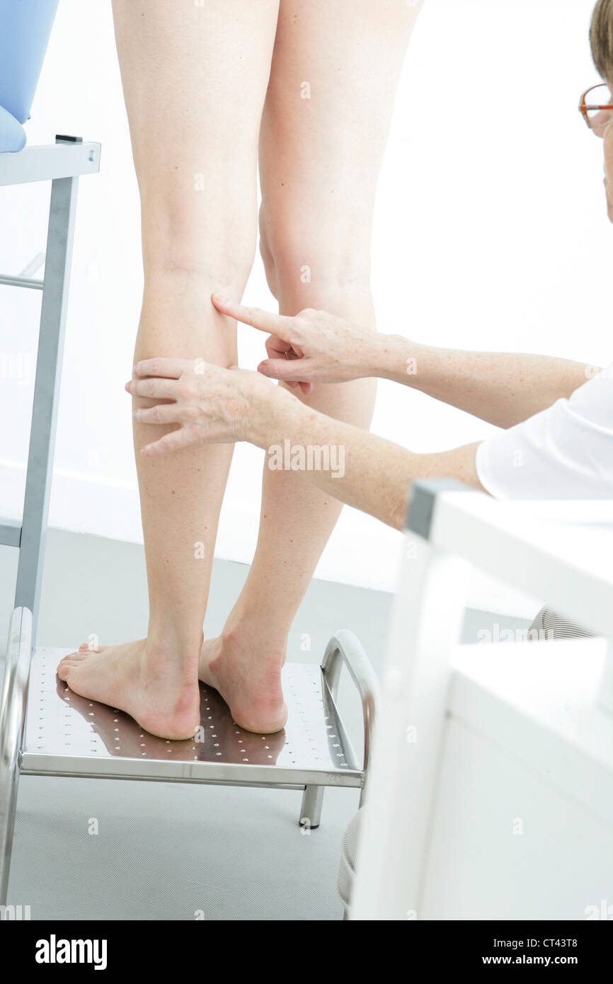 LEG, SYMPTOMATOLOGY IN A WOMAN Stock Photo