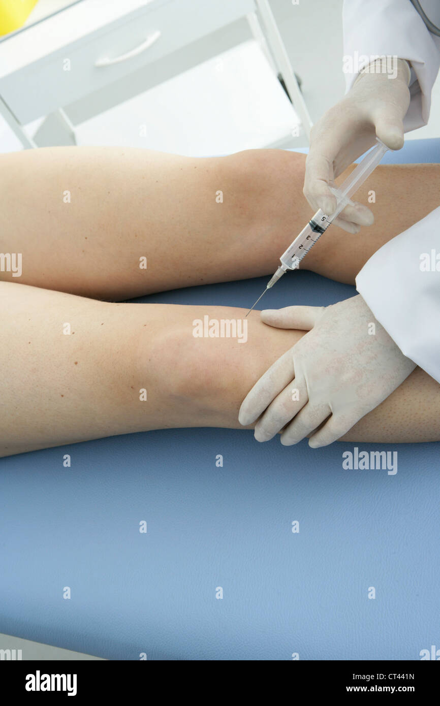 KNEE, INFILTRATION Stock Photo