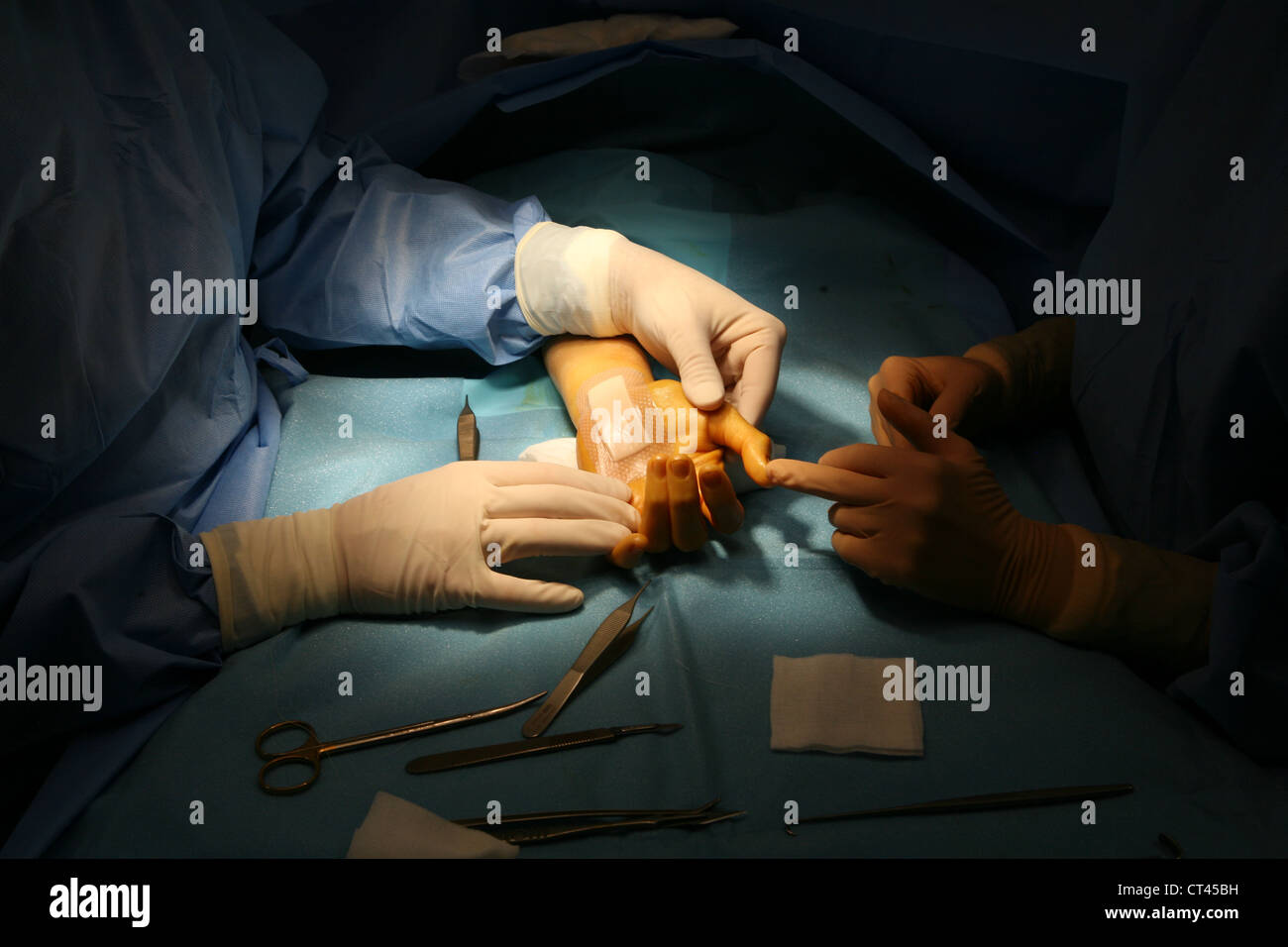 CARPAL TUNNEL, SURGERY Stock Photo - Alamy