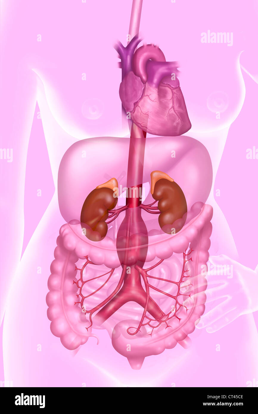 ANEURYSM OF THE ABDOMINAL AORTA Stock Photo