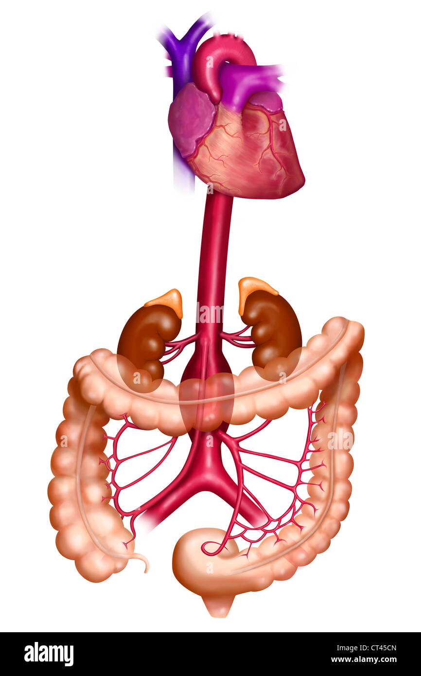 ANEURYSM OF THE ABDOMINAL AORTA Stock Photo