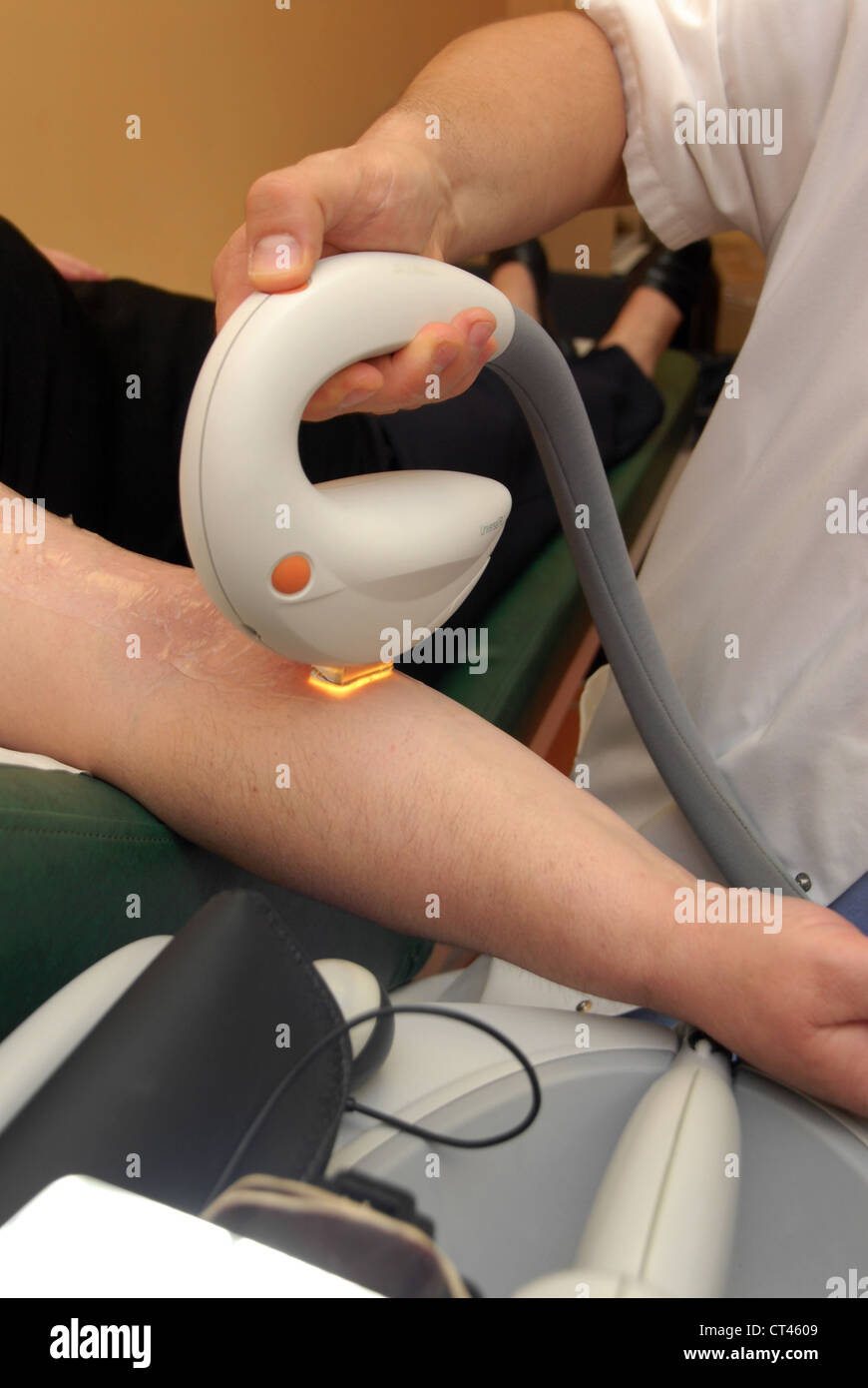 DERMATOLOGY, TREATING A WOMAN Stock Photo