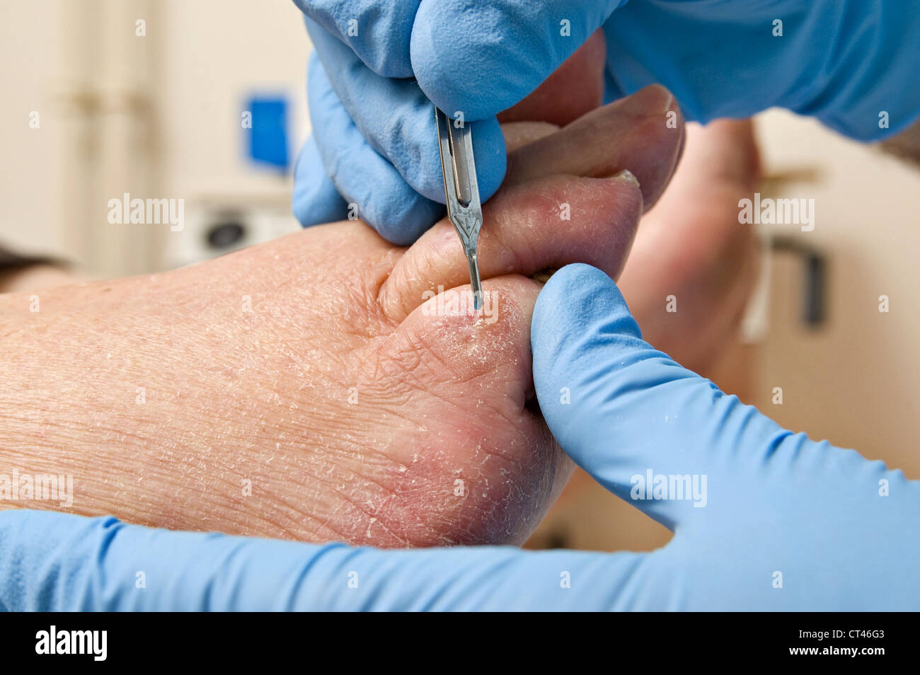 DIABETIC FOOT CARE Stock Photo Alamy