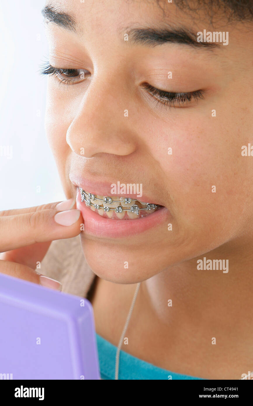 12 year old girl braces hires stock photography and images Alamy