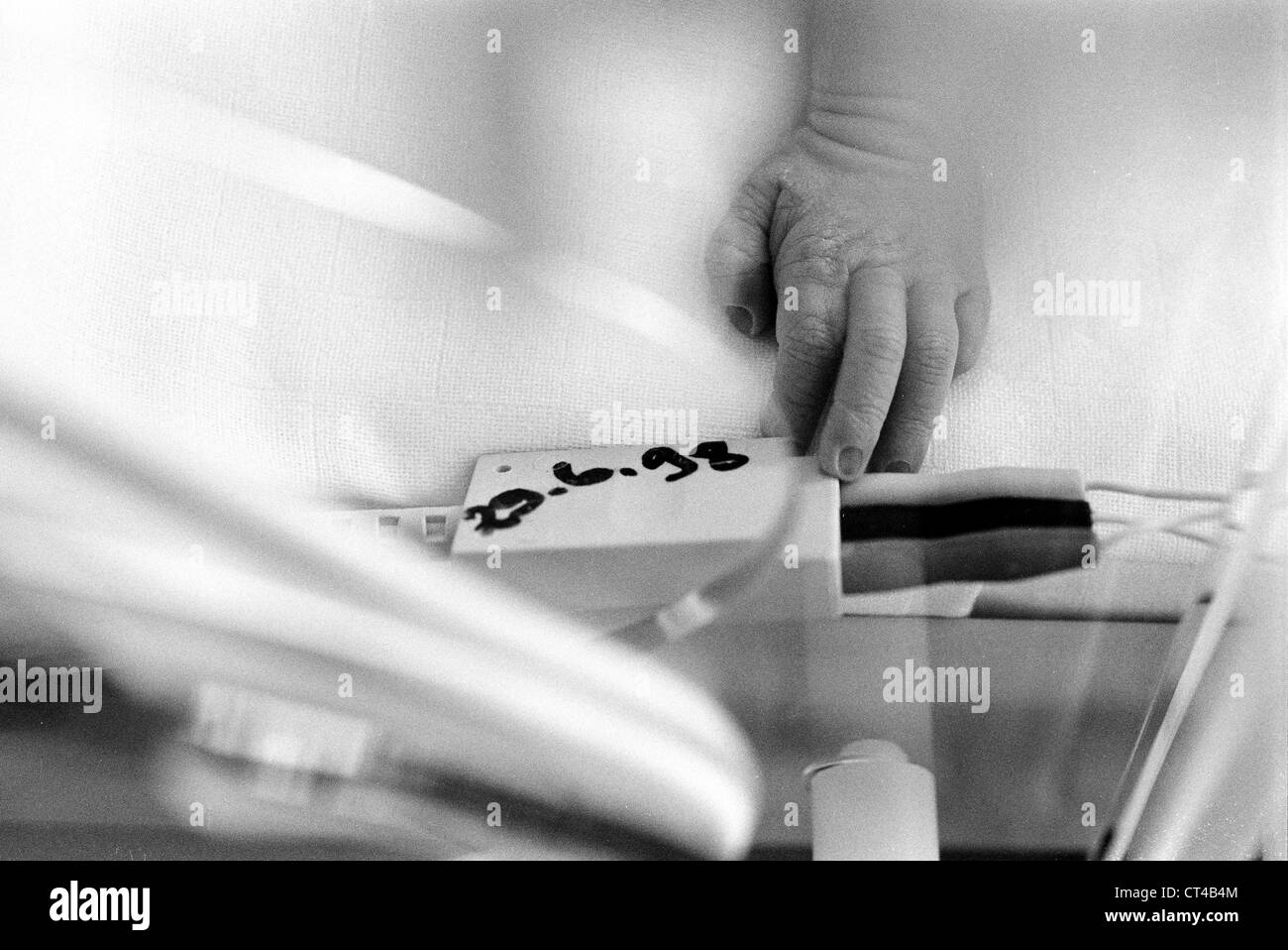 HAND OF PREMATURE BABY Stock Photo Alamy