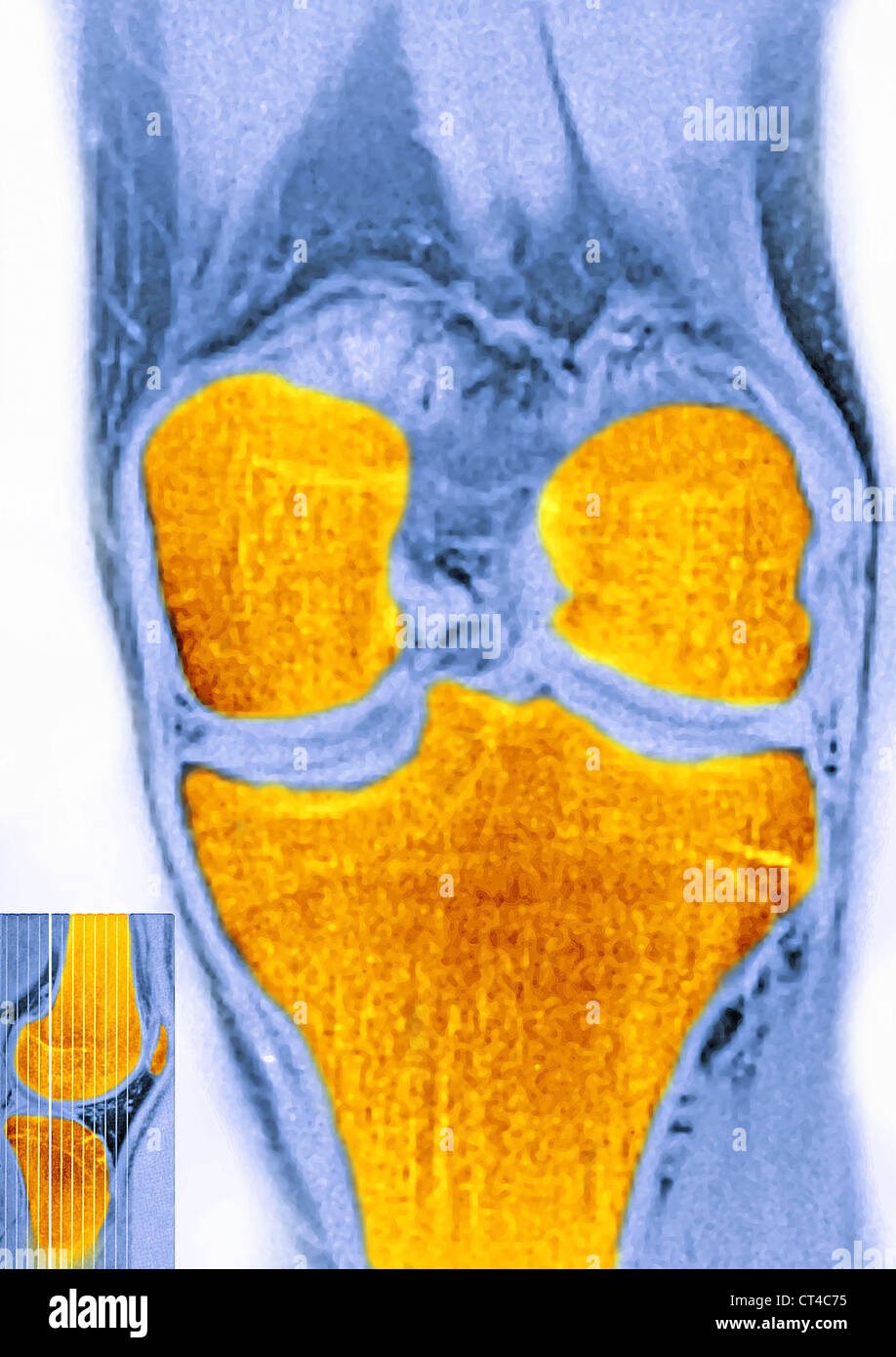 KNEE, MRI Stock Photo Alamy