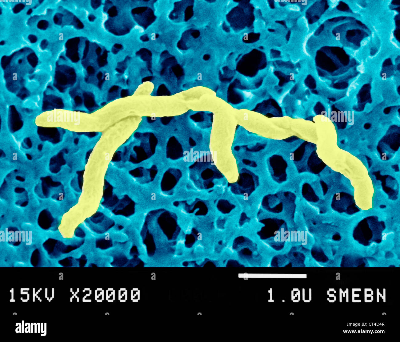 Campylobacter jejuni bacteria hi-res stock photography and images - Alamy