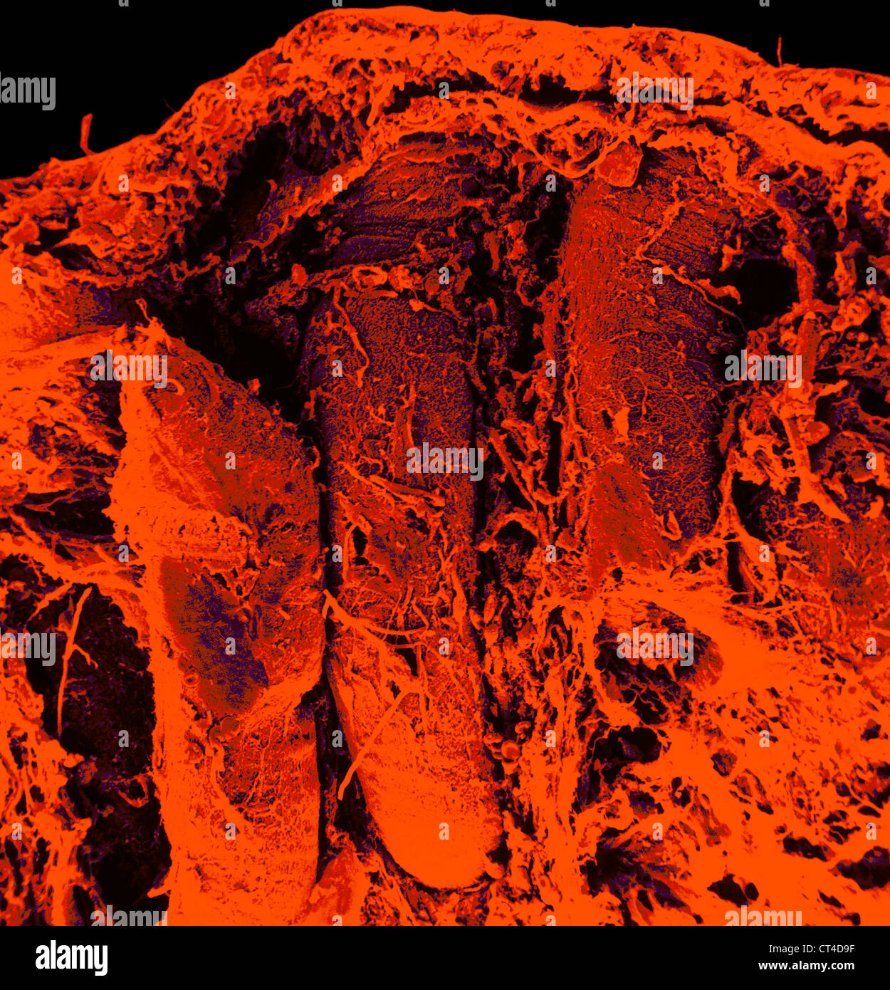CRYPTS OF LIEBERKUHN, SEM Stock Photo - Alamy