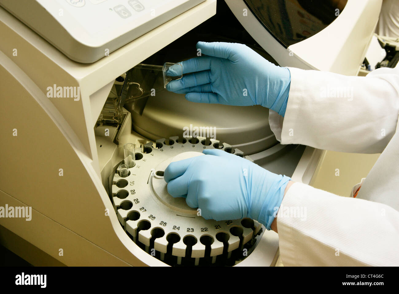 Automated analyser hi-res stock photography and images - Alamy