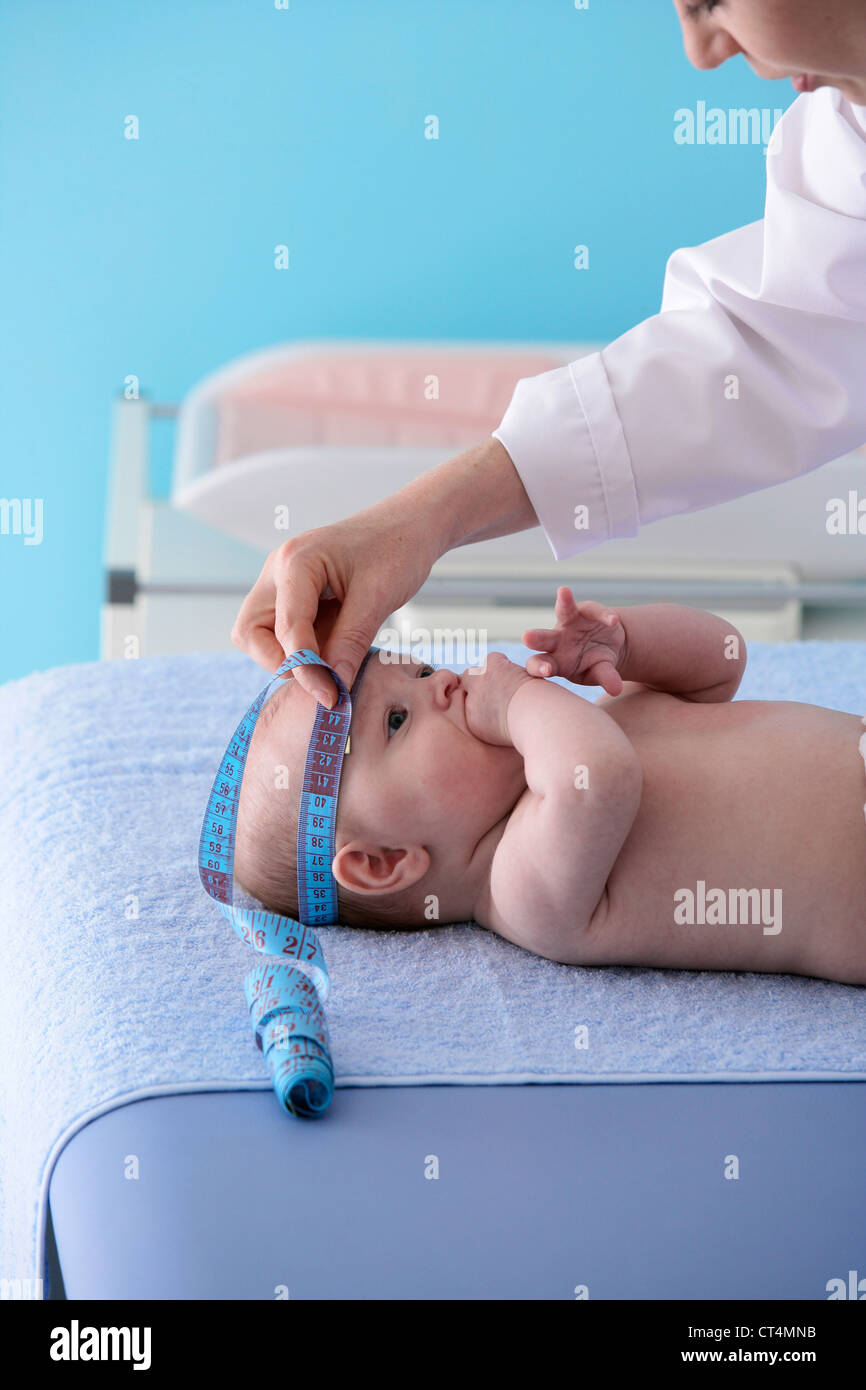 Родничок быстро. Измерение головы новорожденного. Родничок у новорожденных. Измерение большого родничка.