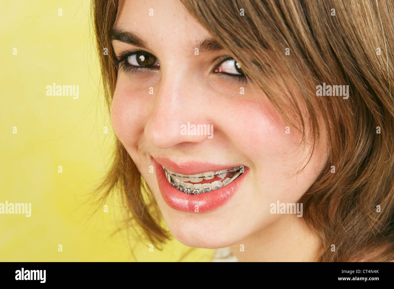 13 year old girl braces hires stock photography and images Alamy