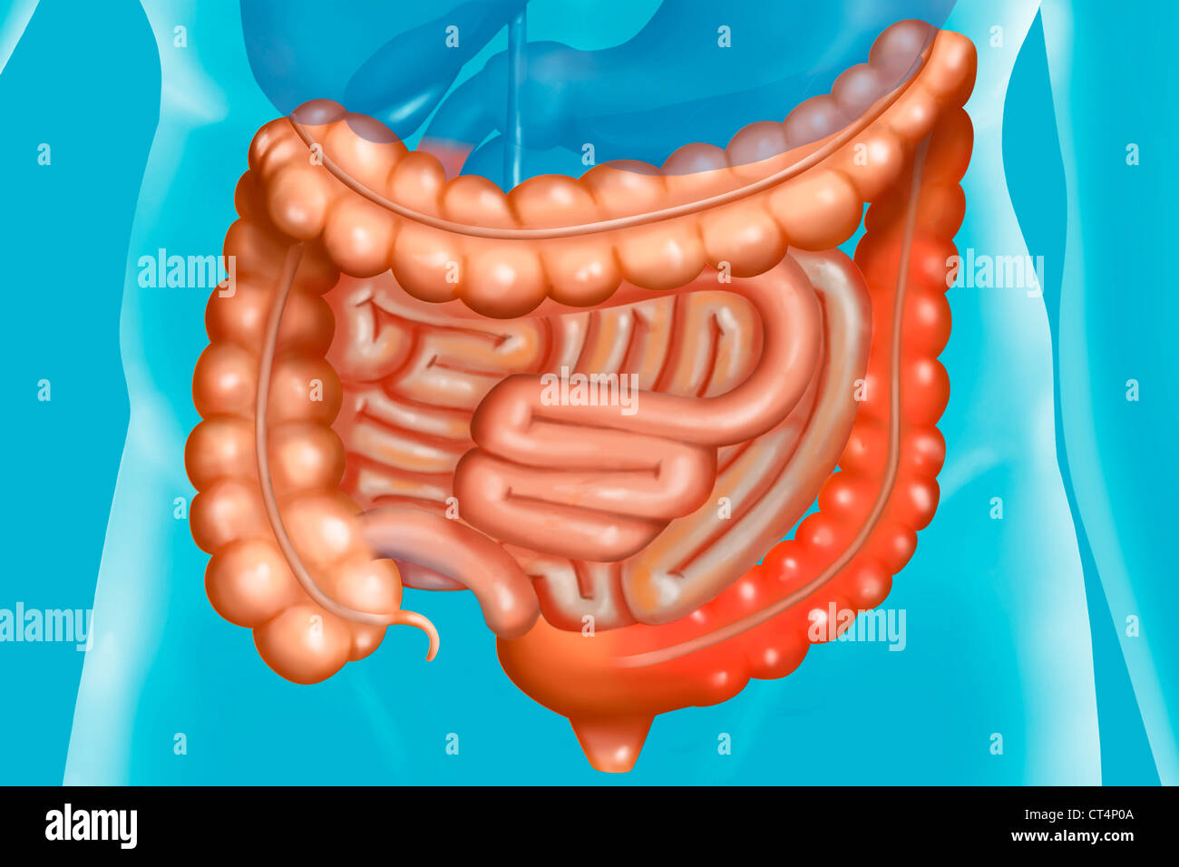 Sigmoiditis hi-res stock photography and images - Alamy