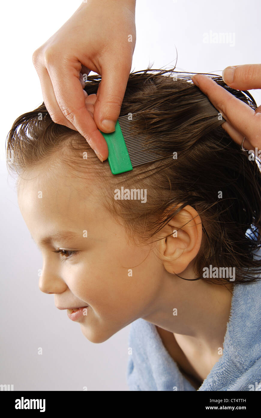 TREATMENT FOR LICE Stock Photo Alamy