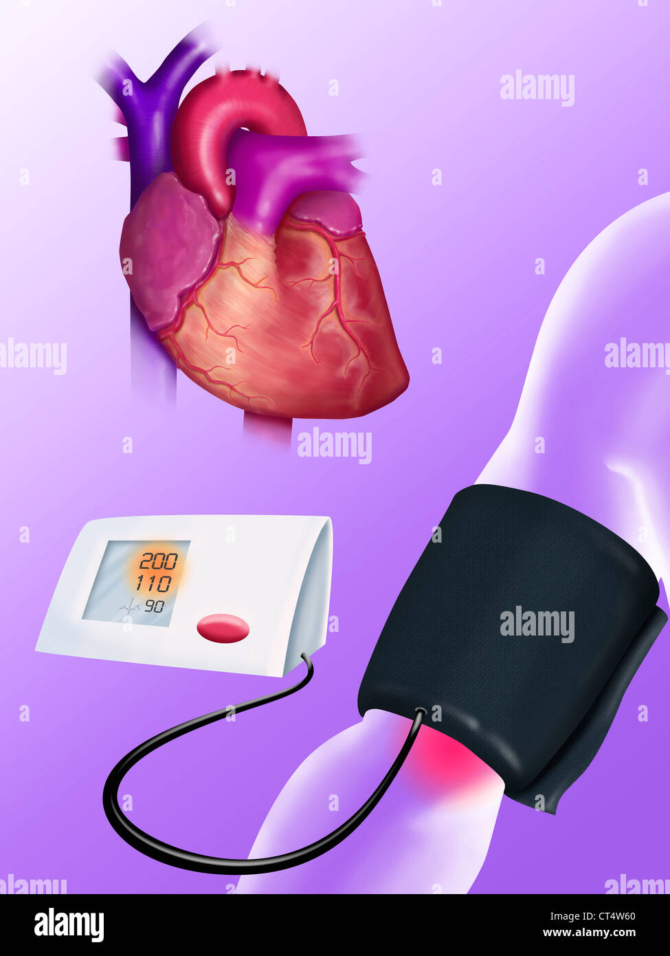 HIGH BLOOD PRESSURE, DRAWING Stock Photo