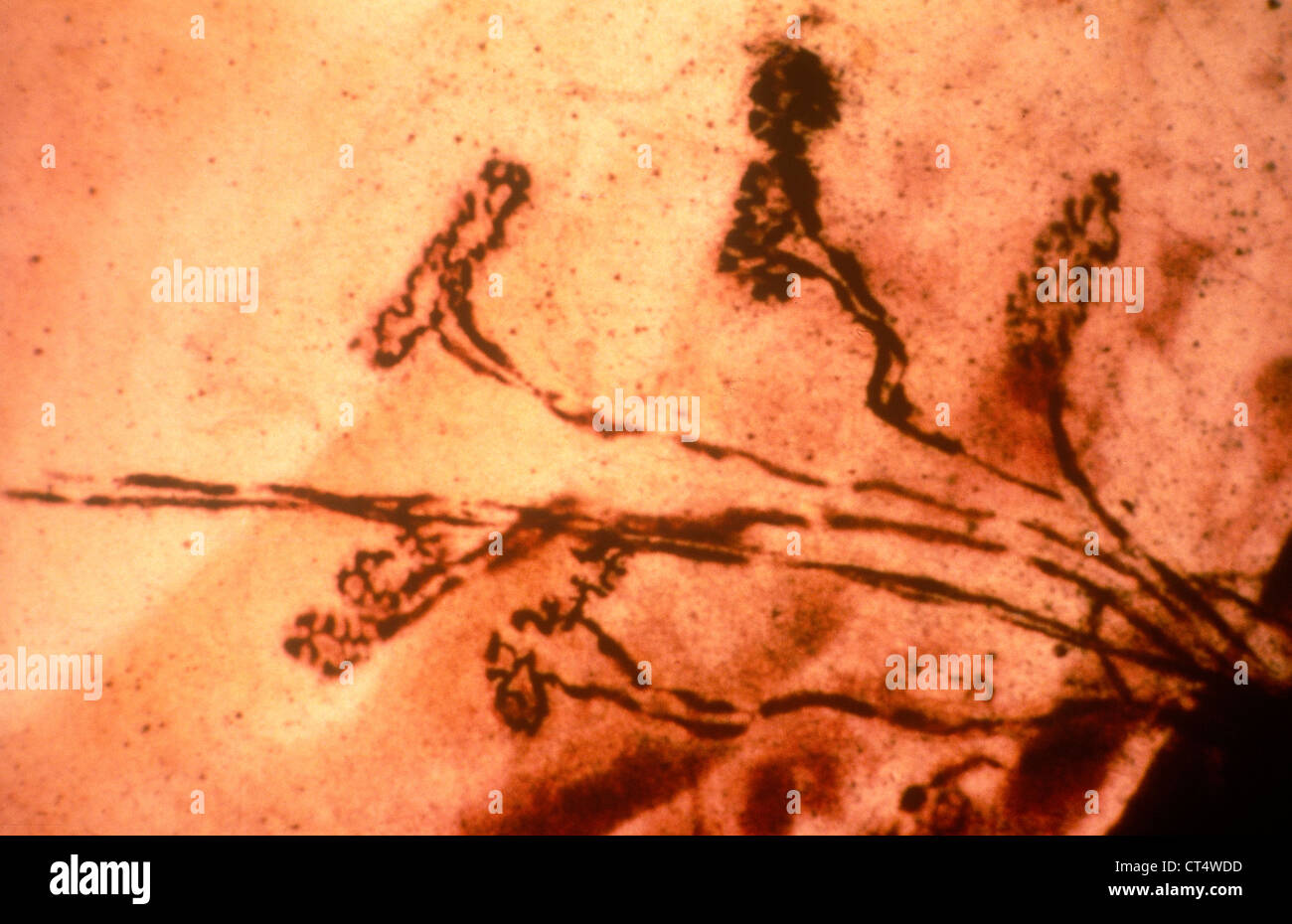 Neuromuscular junction hires stock photography and images Alamy