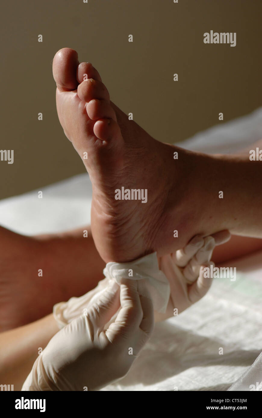 Wound care cream hi-res stock photography and images - Alamy