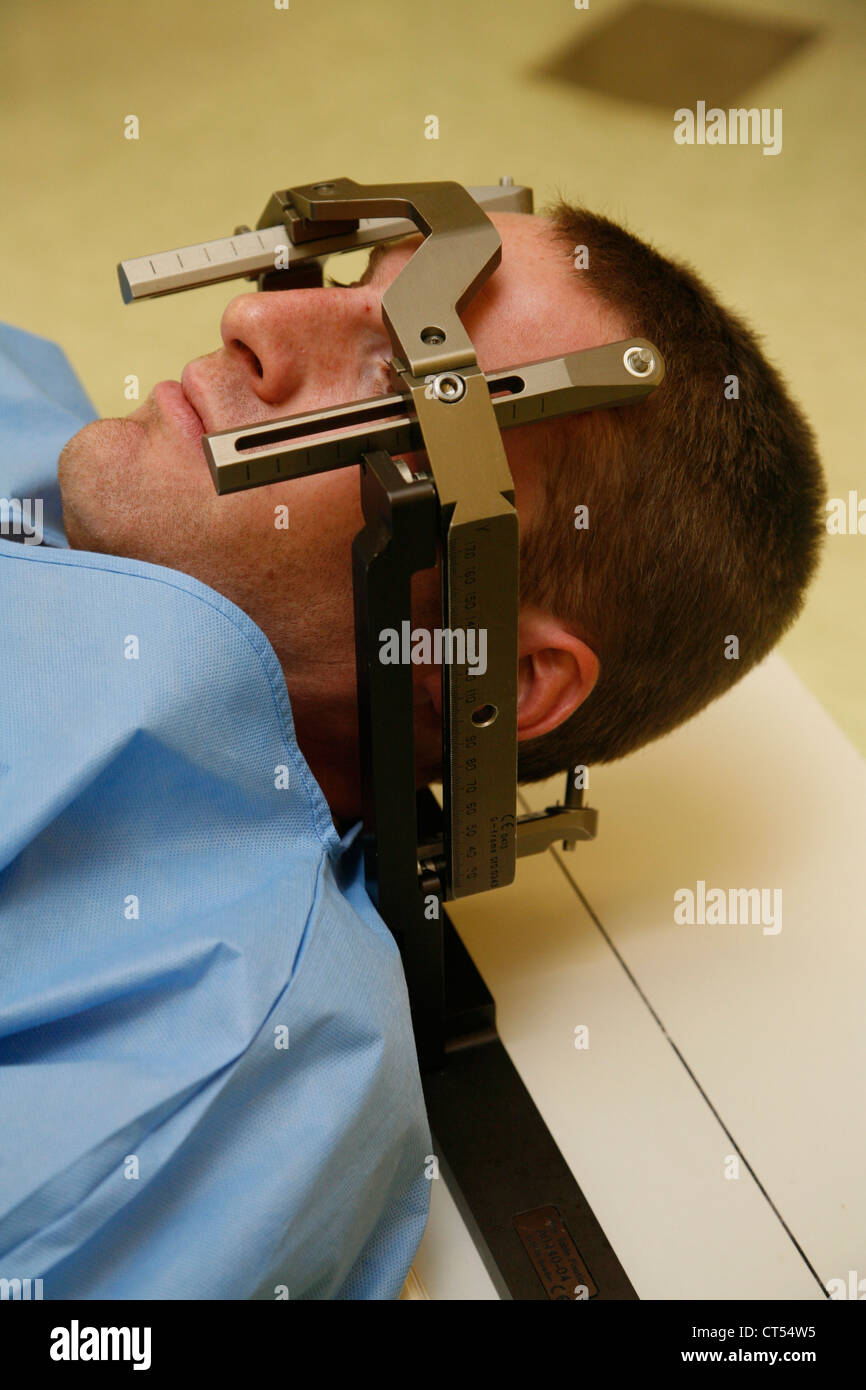 CEREBRAL ARTERIOGRAPHY Stock Photo