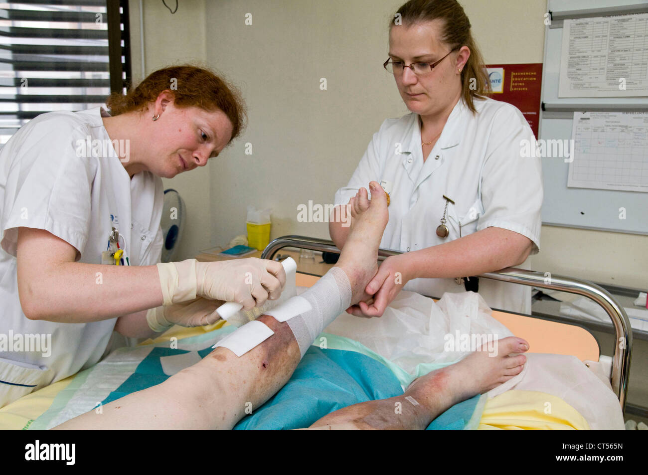 LEG ULCERS CARE Stock Photo Alamy