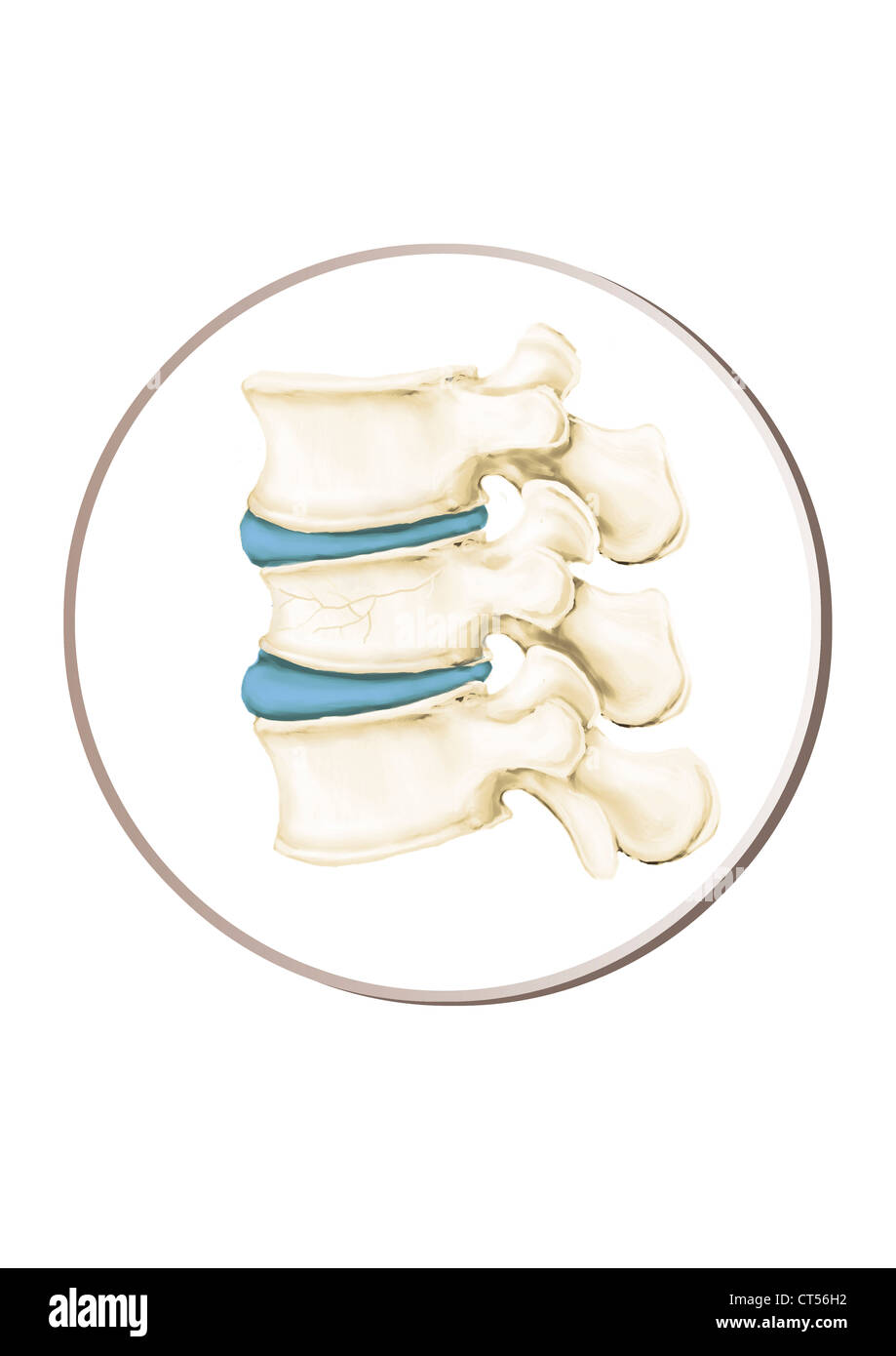 Compression Fracture Spine High Resolution Stock Photography and Images