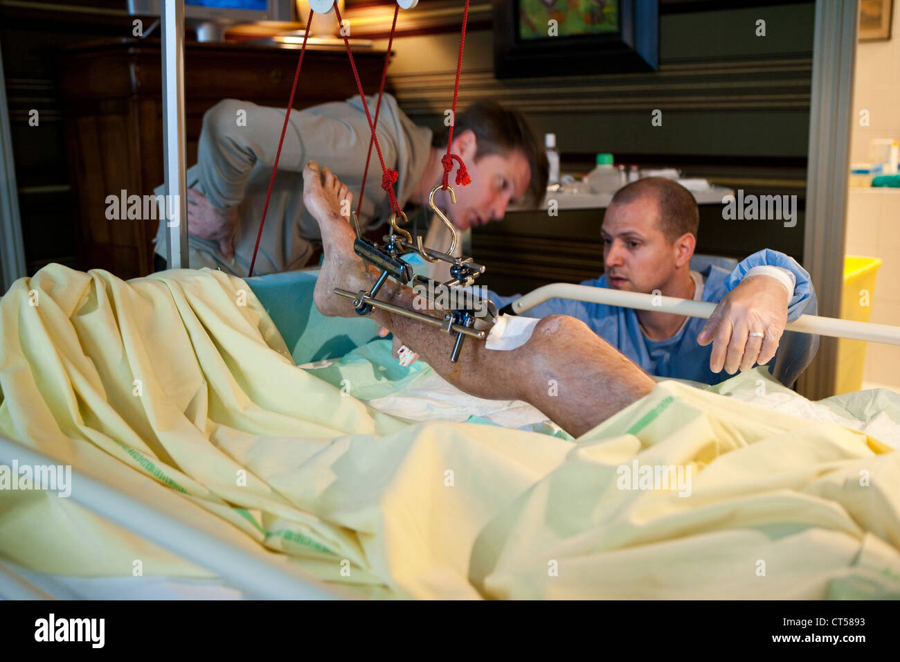 FRACTURED LEG CARE Stock Photo - Alamy