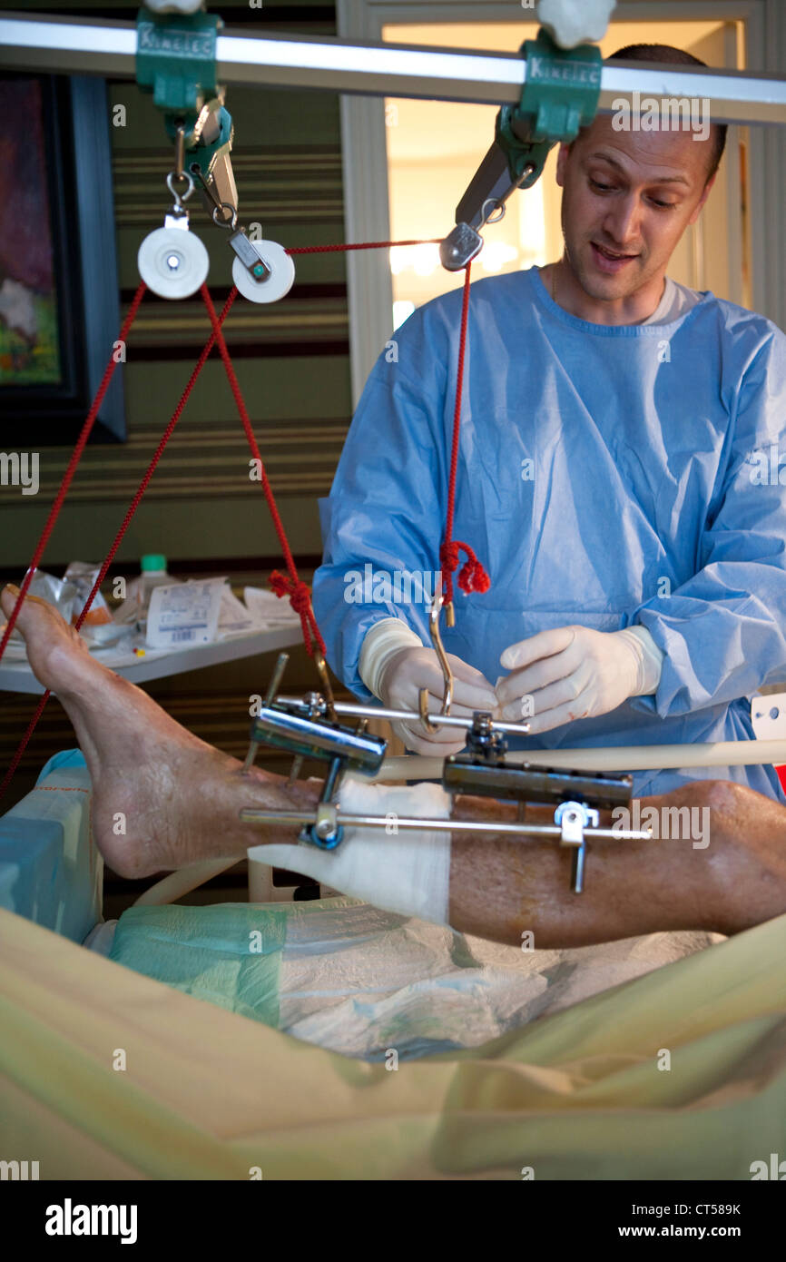 FRACTURED LEG CARE Stock Photo - Alamy
