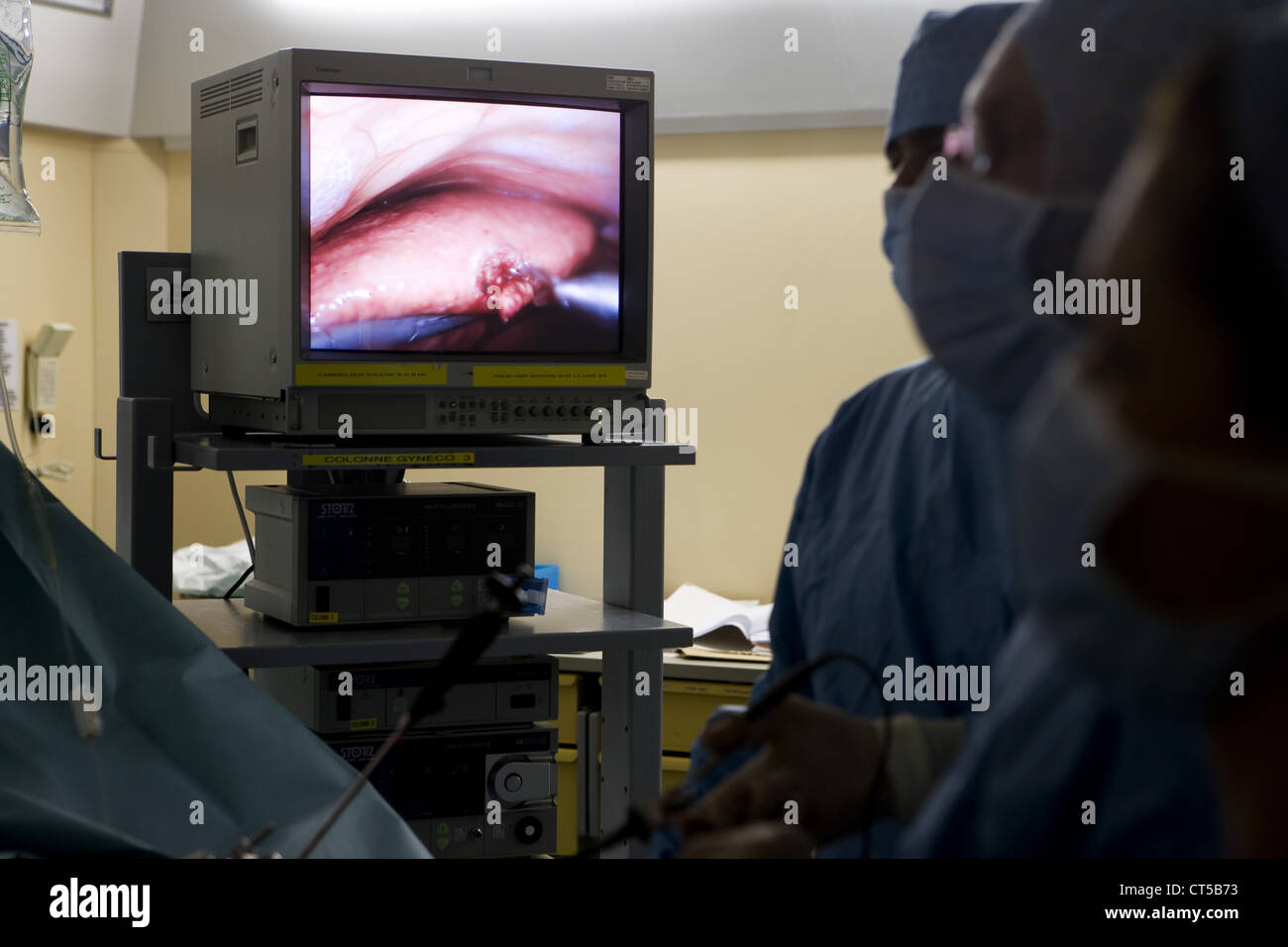 Laparoscopic liver biopsy hires stock photography and images Alamy