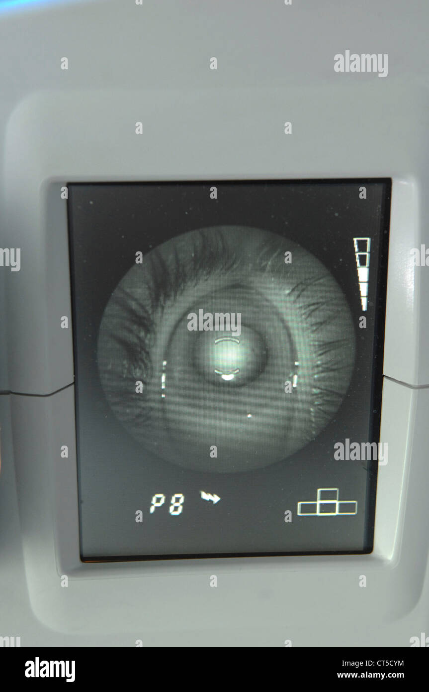 FUNDUS OCULI EXAMINATION Stock Photo