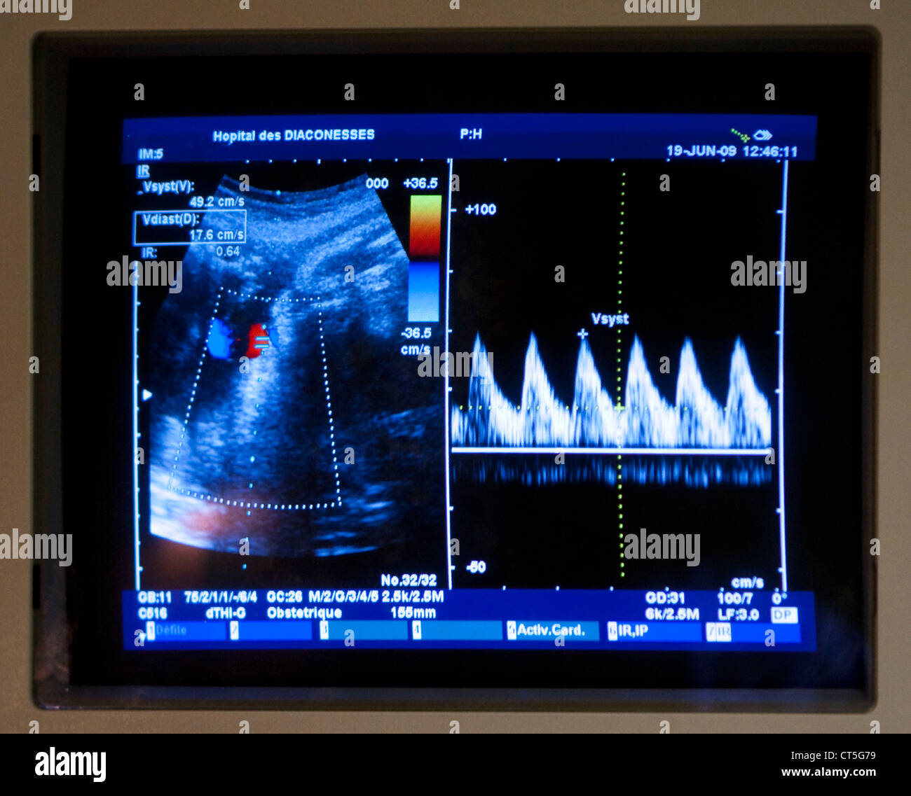 Biometry High Resolution Stock Photography and Images - Alamy