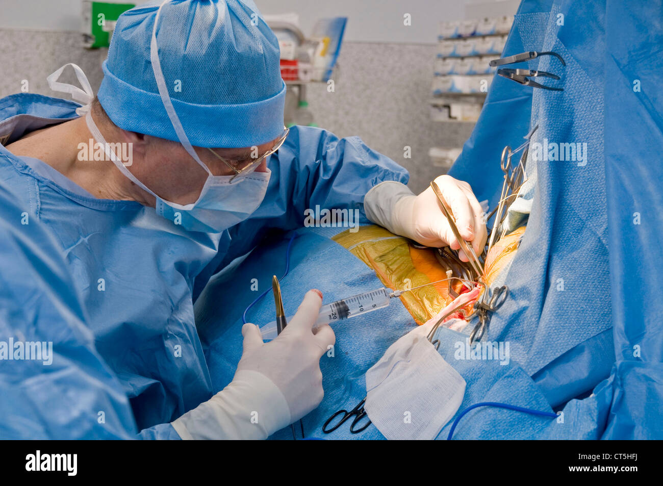 CAROTID, SURGERY Stock Photo