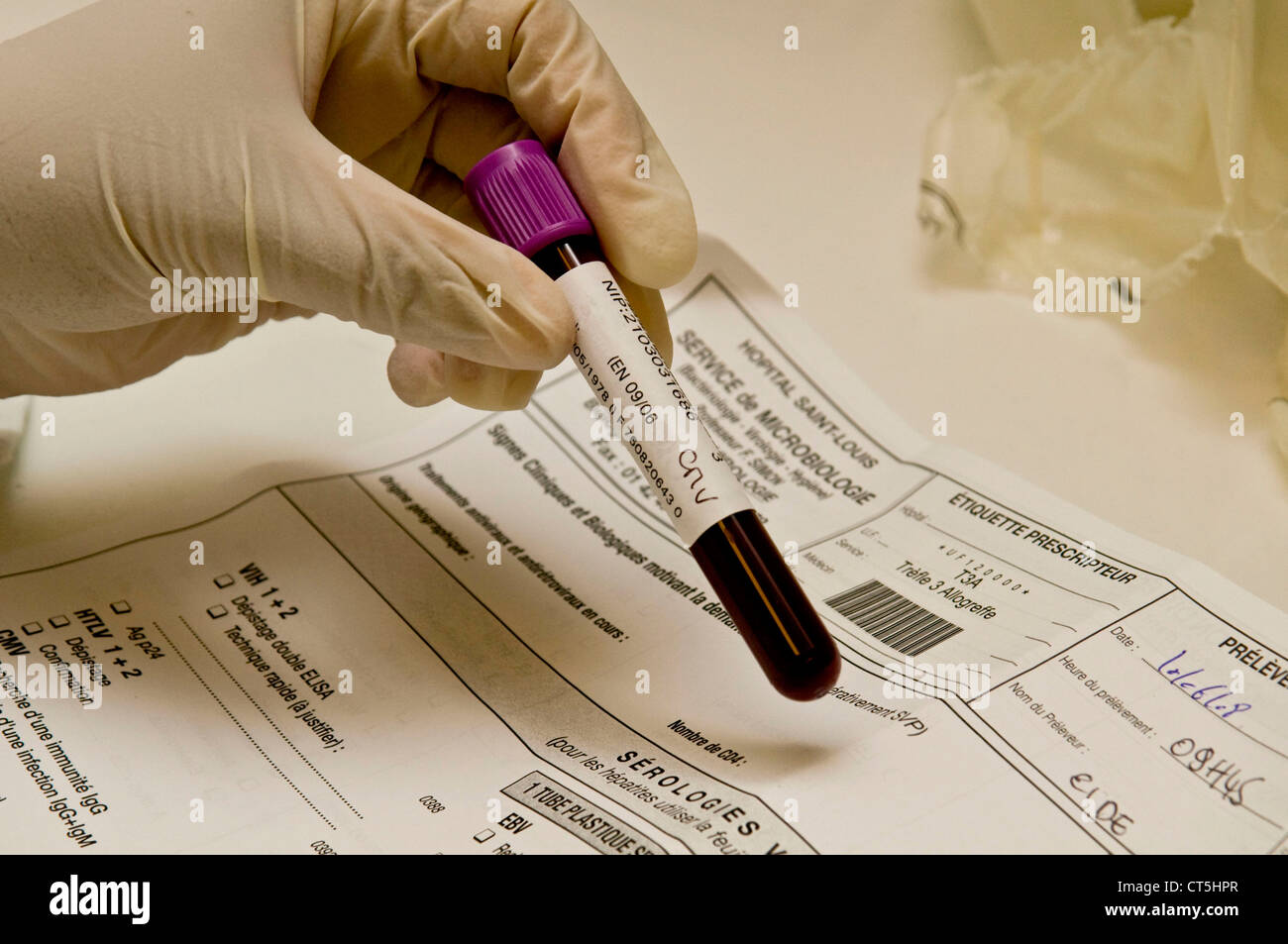 Blood Test Form High Resolution Stock Photography and Images Alamy