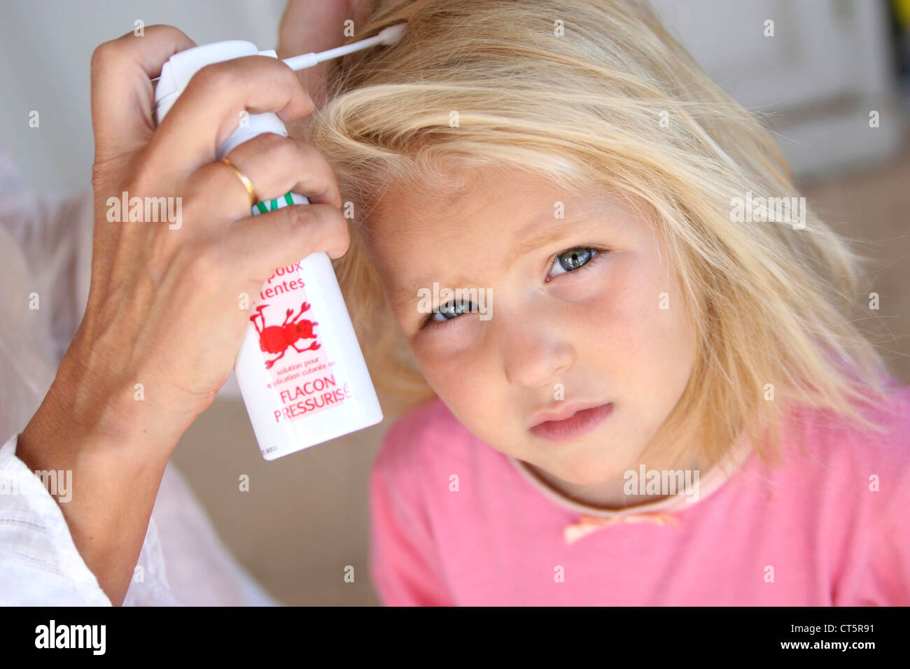 TREATMENT FOR LICE Stock Photo Alamy