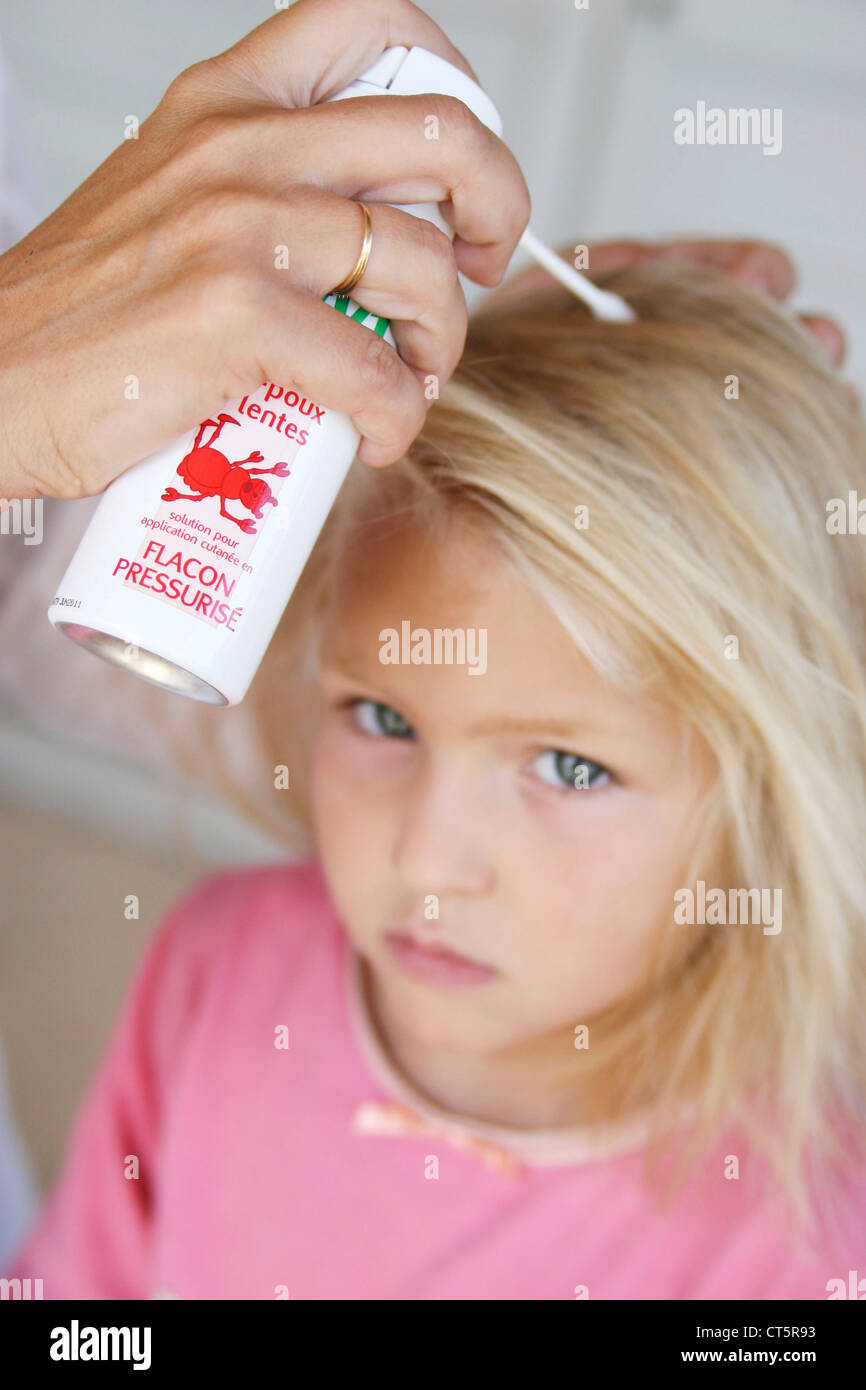 TREATMENT FOR LICE Stock Photo Alamy