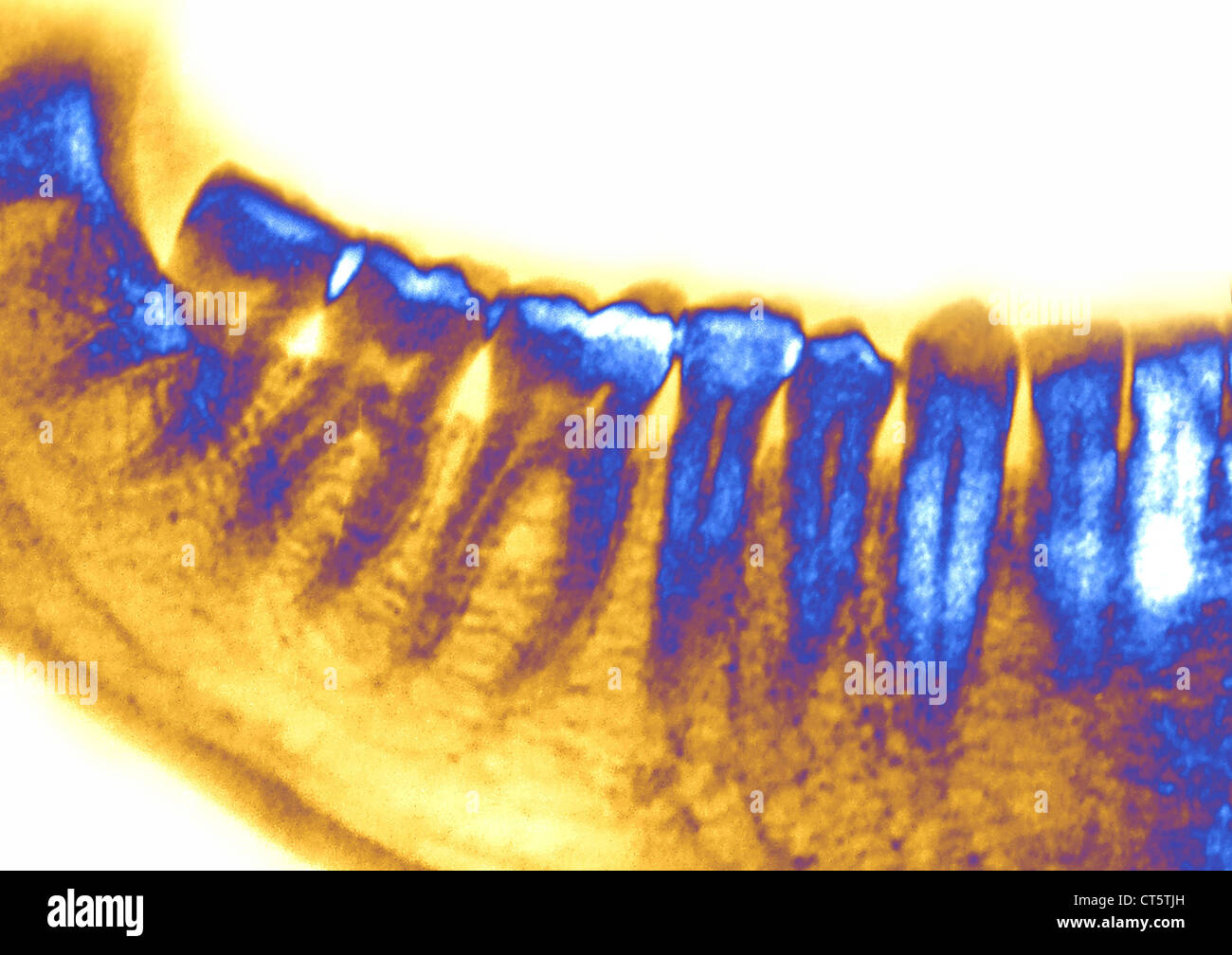 Human teeth lower cuspids hires stock photography and images Alamy