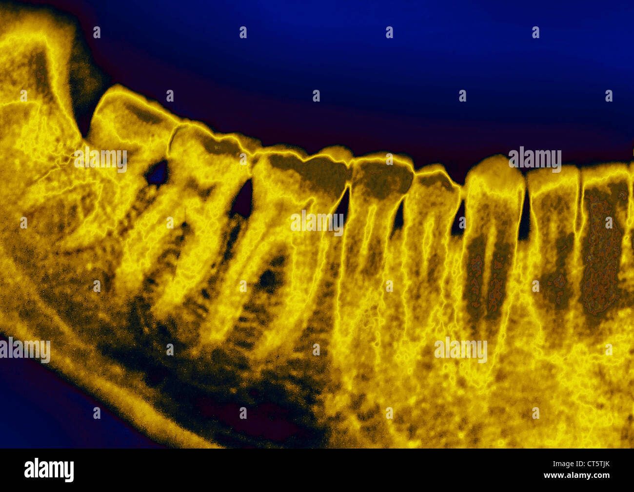 DENTAL XRAY RESULT Stock Photo Alamy